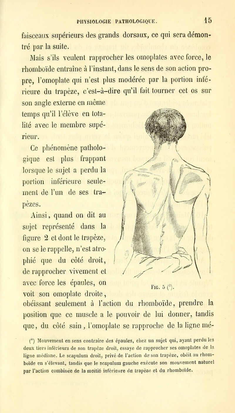 faisceaux supérieurs des grands dorsaux, ce qui sera démon- tré par la suite. Mais s'ils veulent rapprocher les omoplates avec force, le rhomboïde entraîne à l'instant, dans le sens de son action pro- pre, l'omoplate qui n'est plus modérée par la portion infé- rieure du trapèze, c'est-à-dire qu'il fait tourner cet os sur son angle externe en même temps qu'il l'élève en tota- lité avec le membre supé- rieur. Ce phénomène patholo- gique est plus frappant lorsque le sujet a perdu la portion inférieure seule- ment de l'un de ses tra- pèzes. Ainsi, quand on dit au sujet représenté dans la figure 2 et dont le trapèze, on se le rappelle, n'est atro- phié que du côté droit, de rapprocher vivement et avec force les épaules, on voit son omoplate droite, obéissant seulement à l'aclion du rhomboïde, prendre la position que ce muscle a le pouvoir de lui donner, tandis que, du côté sain, l'omoplate se rapproche de la ligne mé- (*) Mouvement en sens contraire des épaules, chez un sujet qui, ayant perdu les deux tiers inférieurs de son trapèze droit, essaye de rapprocher ses omoplates de la ligne médiane. Le scapulum droit, privé de Faction de son trapèze, obéit au rhom- boïde en s'élevant, tandis que le scapulum gauche exécute son mouvement naturel par Taction combinée de la moitié inférieure du trapèze et du rhomboïde,