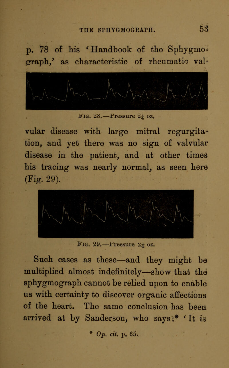 p. 78 of his * Handbook of the Sphygmo- grraph/ as characteristic of rheumatic val- i^IG. '£#.—-Pressure 'A£ oz. vular disease with large mitral regurgita- tion, and yet there was no sign of valvular disease in the patient, and at other times his tracing was nearly normal, as seen here (Fig. 29). 1'IG. 2y.—Pressure Z£ oz. Such cases as these—and they might be multiplied almost indefinitely—show that the sphygmograph cannot be relied upon to enable us with certainty to discover organic affections of the heart. The same conclusion has been arrived at by Sanderson, who says:* ' It is * Op. cit. p. 65.