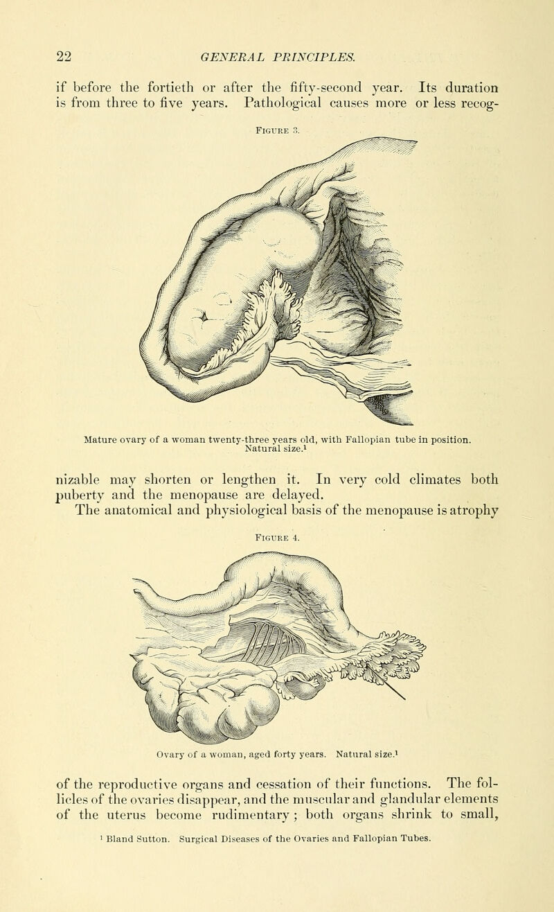 if before the fortieth or after the fifty-second year. Its duration is from three to five years. Pathological causes more or less recog- Mature ovary of a woman twenty-three years old, with Fallopian tube in position. Natural size.i nizable may shorten or lengthen it. In very cold climates both puberty and the menopause are delayed. The anatomical and physiological basis of the menopause is atrophy Figure 4. Ovary of a woman, aged forty years. Natural size.i of the reproductive organs and cessation of their functions. The fol- licles of the ovaries disappear, and the muscular and glandular elements of the uterus become rudimentary; both organs shrink to small,