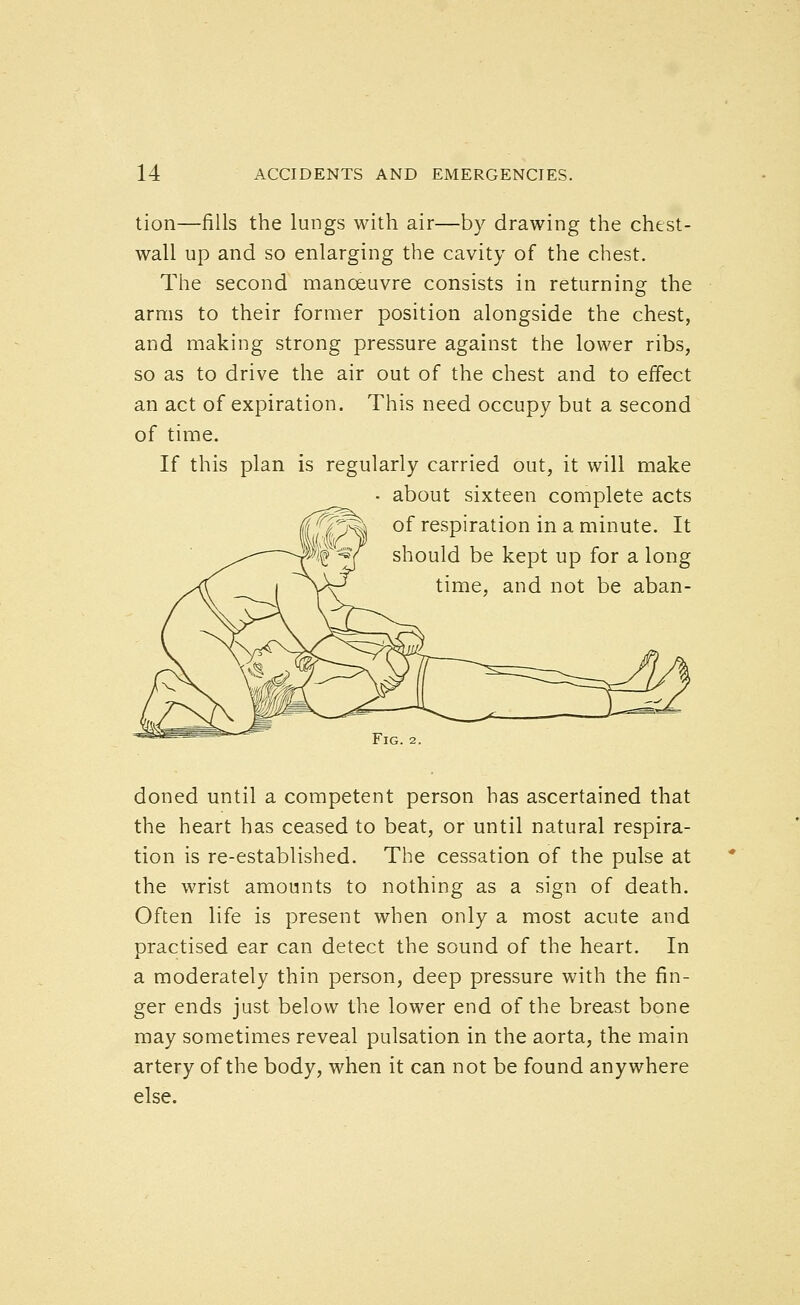 tion—fills the lungs with air—by drawing the chest- wall up and so enlarging the cavity of the chest. The second manoeuvre consists in returning the arms to their former position alongside the chest, and making strong pressure against the lower ribs, so as to drive the air out of the chest and to effect an act of expiration. This need occupy but a second of time. If this plan is regularly carried out, it will make about sixteen complete acts of respiration in a minute. It should be kept up for a long time, and not be aban- FlG. 2 doned until a competent person has ascertained that the heart has ceased to beat, or until natural respira- tion is re-established. The cessation of the pulse at the wrist amounts to nothing as a sign of death. Often life is present when only a most acute and practised ear can detect the sound of the heart. In a moderately thin person, deep pressure with the fin- ger ends just below the lower end of the breast bone may sometimes reveal pulsation in the aorta, the main artery of the body, when it can not be found anywhere else.