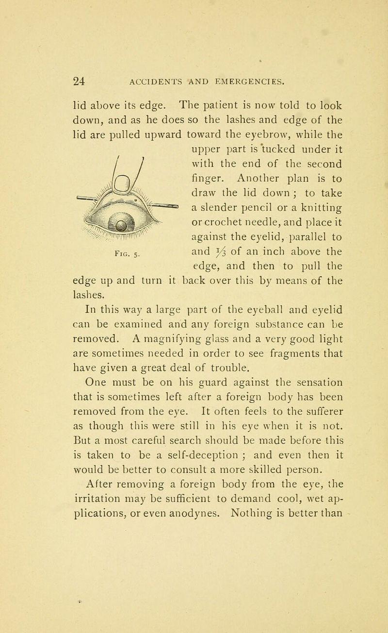 lid above its edge. The patient is now told to look down, and as he does so the lashes and edge of the lid are pulled upward toward the eyebrow, while the upper part is 'tucked under it with the end of the second finger. Another plan is to draw the lid down ; to take a slender pencil or a knitting ^^ _ or crochet needle, and place it ''>r^jiiTTiTT^ against the eyelid, parallel to Fig. 5. and ^ of an inch above the edge, and then to pull the edge up and turn it back over this by means of the lashes. In this way a large part of the eyeball and eyelid can be examined and any foreign substance can be removed. A magnifying glass and a very good light are sometimes needed in order to see fragments that have given a great deal of trouble. One must be on his guard against the sensation that is sometimes left after a foreign body has been removed from the eye. It often feels to the sufferer as though this were still in his eye when it is not. But a most careful search should be made before this is taken to be a self-deception ; and even then it would be better to consult a more skilled person. After removing a foreign body from the eye, the irritation may be sufficient to demand cool, wet ap- plications, or even anodynes. Nothing is better than