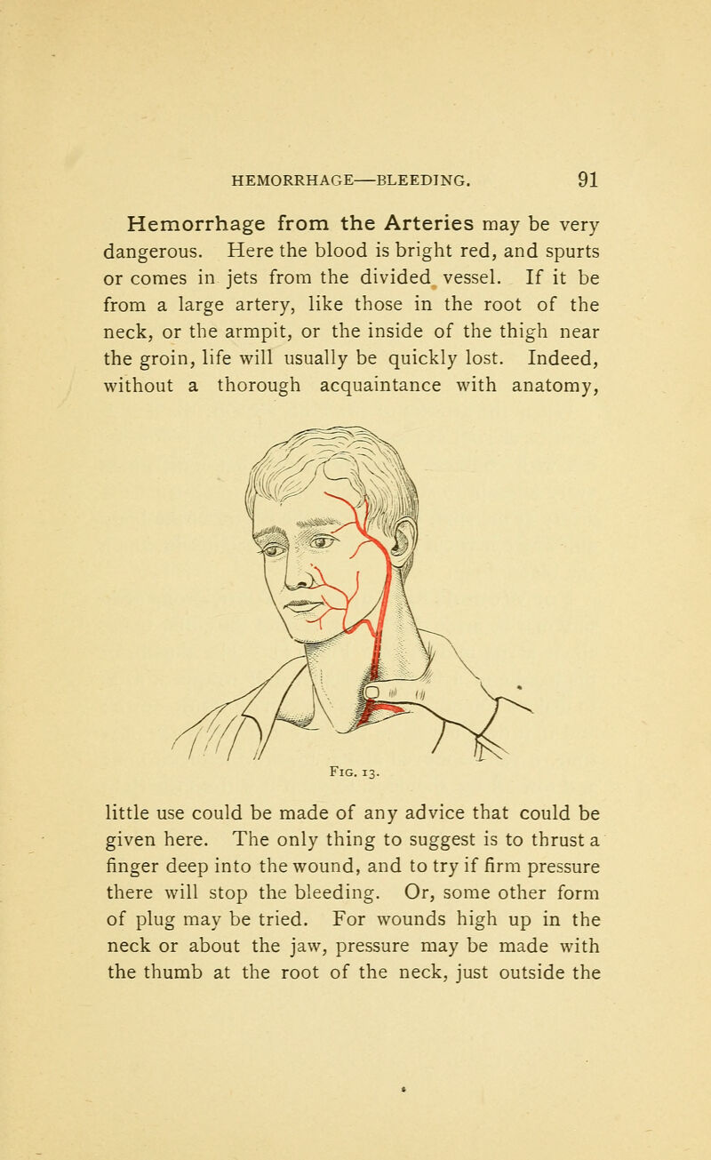 Hemorrhage from the Arteries may be very dangerous. Here the blood is bright red, and spurts or comes in jets from the divided vessel. If it be from a large artery, like those in the root of the neck, or the armpit, or the inside of the thigh near the groin, life will usually be quickly lost. Indeed, without a thorough acquaintance with anatomy, little use could be made of any advice that could be given here. The only thing to suggest is to thrust a finger deep into the wound, and to try if firm pressure there will stop the bleeding. Or, some other form of plug may be tried. For wounds high up in the neck or about the jaw, pressure may be made with the thumb at the root of the neck, just outside the