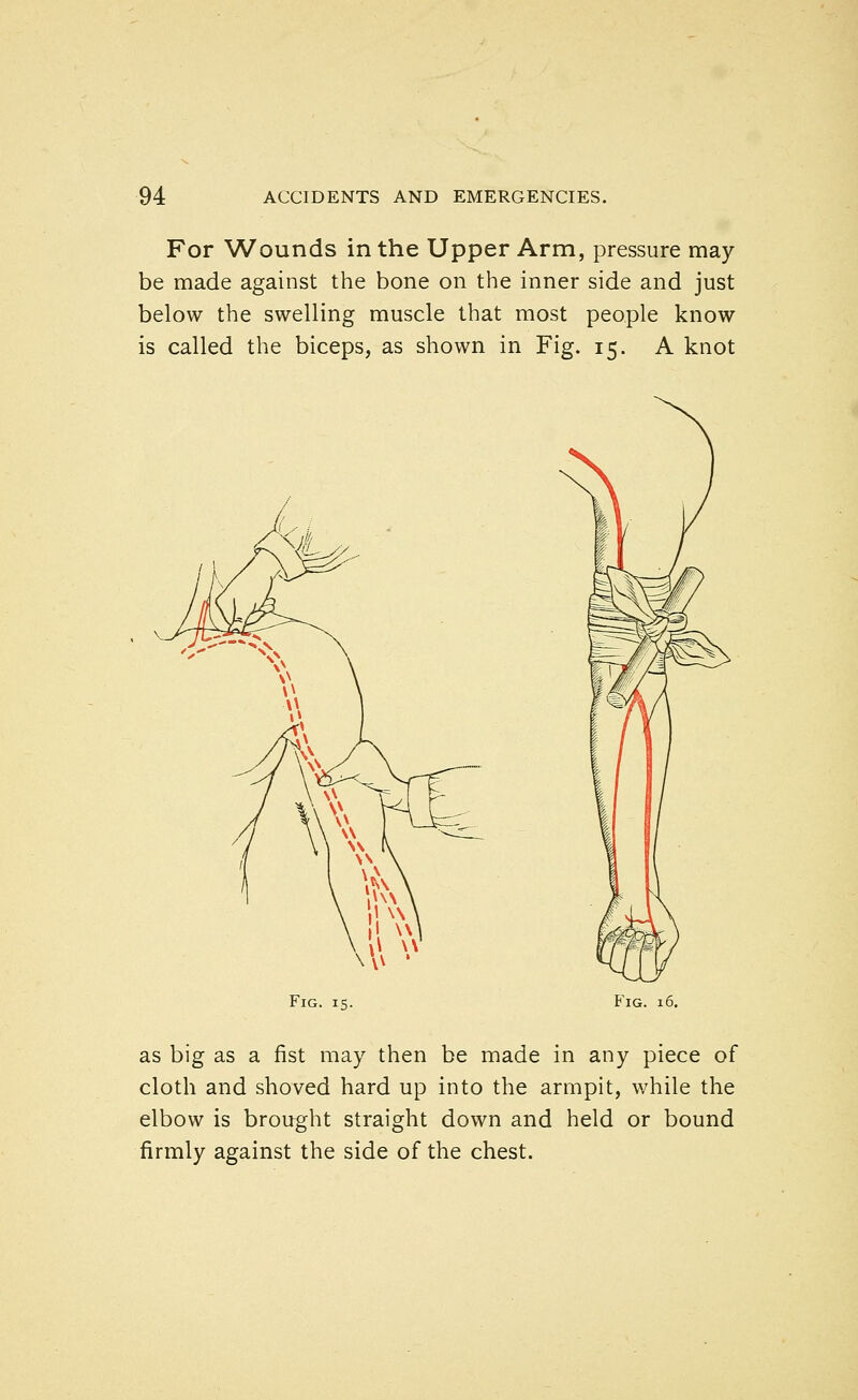 For Wounds in the Upper Arm, pressure may be made against the bone on the inner side and just below the swelling muscle that most people know is called the biceps, as shown in Fig. 15. A knot Fig. is. Fig. 16. as big as a fist may then be made in any piece of cloth and shoved hard up into the armpit, while the elbow is brought straight down and held or bound firmly against the side of the chest.