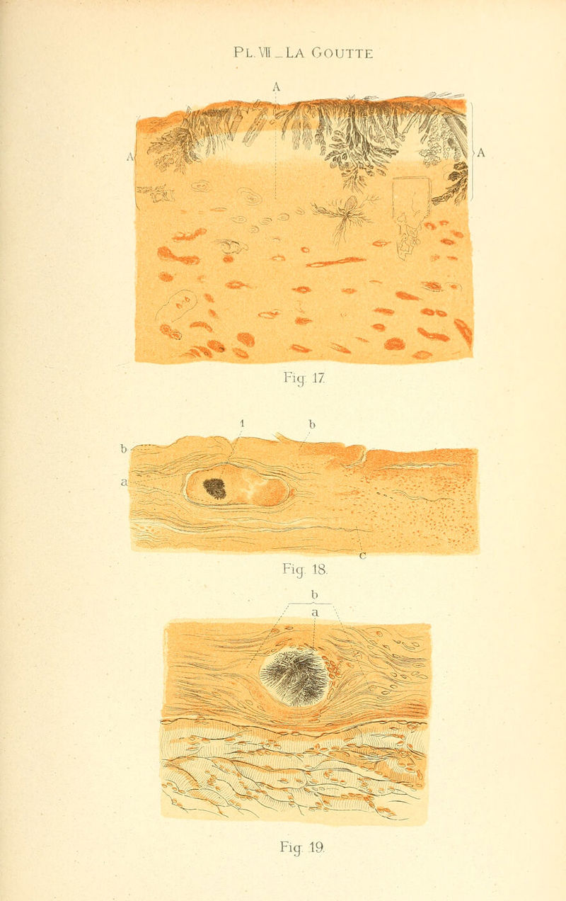 A H ifé^M Fig-, 1/ 1) -'• Fig. 18. b_ a Fig. 19.