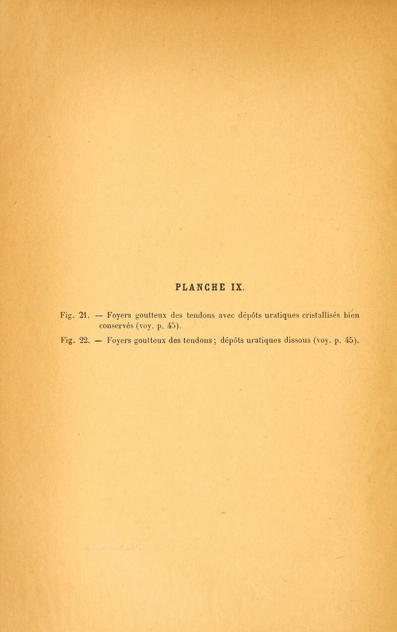 Fig. 21. — Foyers goutteux des tendons avec dépôts uratiques cristallisés bien conservés (voy. p. 45).