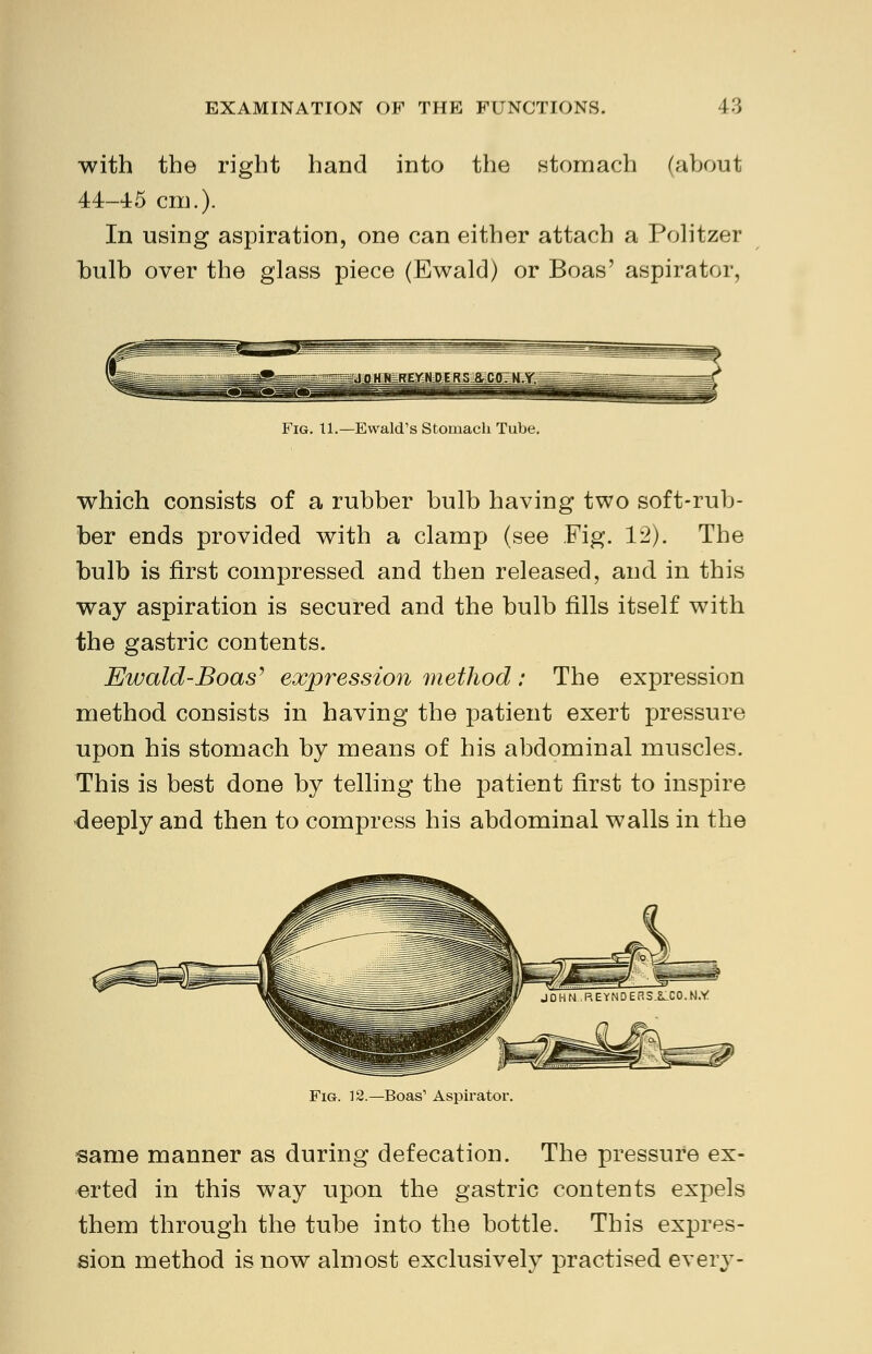 with the right hand into the stomach (about 44-45 cm.). In using aspiration, one can either attach a Politzer bulb over the glass piece (Ewald) or Boas' aspirator, Fig. 11.— Ewald's Stomach Tube. which consists of a rubber bulb having two soft-rub- ber ends provided with a clamp (see Fig. 12). The bulb is first compressed and then released, and in this way aspiration is secured and the bulb fills itself with the gastric contents. Ewald-Boas' expression method : The expression method consists in having the patient exert pressure upon his stomach by means of his abdominal muscles. This is best done by telling the patient first to inspire deeply and then to compress his abdominal walls in the JOIINREYNDERS.&LCO.N.* Fig. 12.—Boas1 Aspirator. same manner as during defecation. The pressure ex- erted in this way upon the gastric contents expels them through the tube into the bottle. This expres- sion method is now almost exclusively practised every-