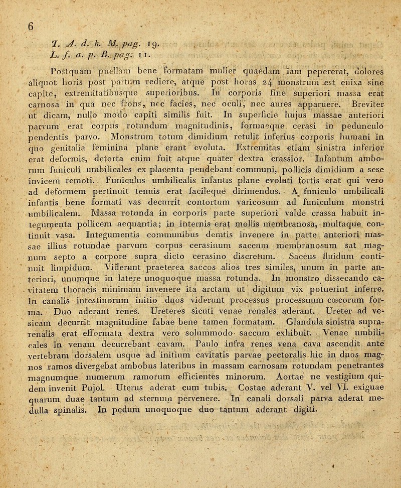 L. f. a. ]}. B. pag. 11. rostquam puell-im bene formatam mulier quaedam.iam pepererat, uolores aliquot horis post partum rediere, atque post horas 24 monstrum esl enixa sine capite, extremitatibusque superioribus. lu corporis fine superiori massa erat carnosa in qua nec frons,, nec facies, nec oculi, nec aures apparuere. Breviter ut dicam, nullo modo capiti similis fait. In supeificie hujus massae anteriori parvum erat corpus rolundum magnitudinis, formaeque cerasi in pedunculo pendentis parvo. Monstrum totum dimidium retuHt inferius corporis liumani in quo genitalia feminina plane eraiit evoluta. Extremitas etiam sinistra inferior erat deformis, detorta enirn fuit atque quater dextra crassior. Infantum ambo- rum furiiculi umbilicales ex plaoenta pendebant communi, poUicis dimidium a sese invicem remoti. Funiculus umbillcalis infantis plane evolnti .fortis erat qui vero ad deformem pertinuit tenuis erat facileque dirimendus. • A^ funiculo umbilicali infantis bene formati vas decurrit contortum varicosum ad funiculum monstri umbilicalem. Massa rotunda in corporis parte superiori valde crassa habuit in- tegfumenta pollicera aequantia; in ihternis erat riiollis membranosa, multaque con- tinuit vasa. Integumentis communibus demtis invenere in parte anteriori mas- sae illius rotundae parvum corpus cerasinum saccum membranosum sat mag- num septo a corpore supra dicto cerasino discretum. Saccus fluidum conti- nuit Hmpidura. ViSerunt praeteirea saccos aUos tres similes, uiium in parte an- teriori, unumque in latere unoquoque massa rotunda. In monstro dissecando ca- vitatem thoracis minimam invenere ita arctam ut digitum vix potuerint inferre. In canalis intestinorum initio diios viderunt processus processuura coscorum for- ma. Duo aderant renes. Ureteres sicuti venae renales aderant. Ureter ad ve- sicara decurrit maguitudine fabae bene tamen formatam. Glandula sinis.tra supra- TenaUs erat efformata dextra vero solummodo- saccum exhibuit. Venae umbiU- oales in venam decurrebant cavam. Paulo infra renes vena cava ascendit ante vertebram dorsalem usque ad initiiim cavitatis parvae pectoraUs hic in duos mag- nos ramos divergebat ambobus lateribus in massam carnosam rotundam penetrantes magnumque numerum ramorum eiFicientes minorum. Aortae xie vestigiura qui- dem invenit Pujol. Uterus aderat cum tubis; Costae aderant V. vel \1. exiguae quarum duae tantum ad sternuiii pervenere. Tn canaU dorsaU parva aderat me- duUa spinaUs. In pedum imoquoque duo tantum aderant digiti.