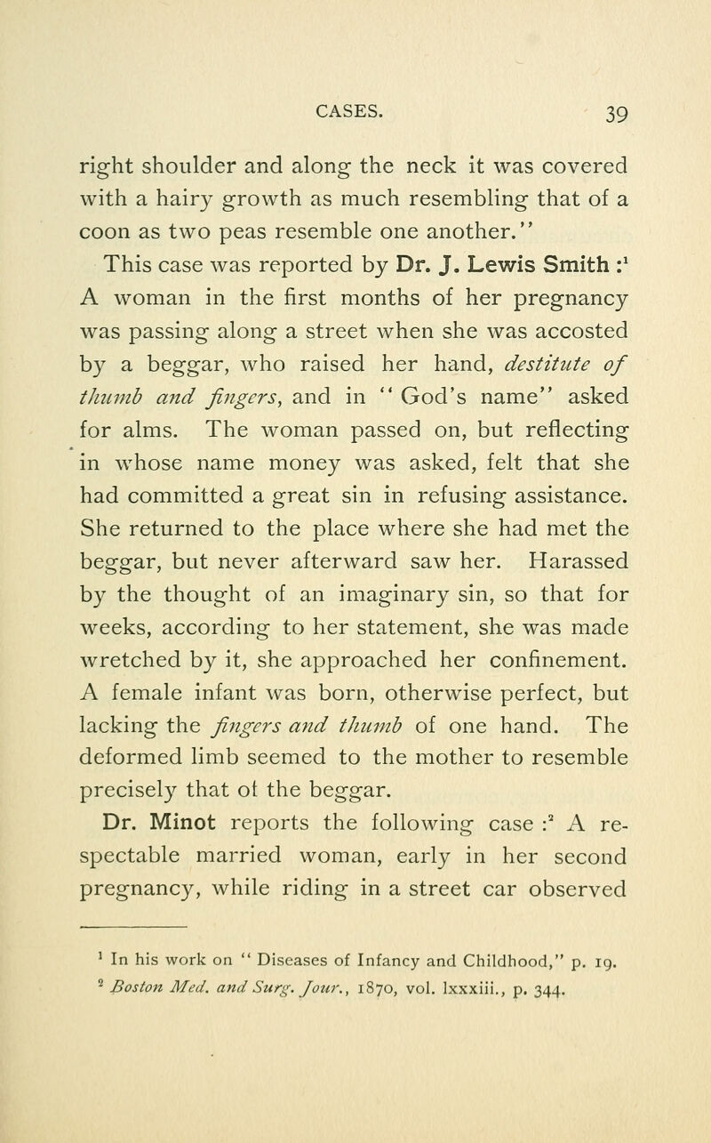 right shoulder and along the neck it was covered with a hairy growth as much resembling that of a coon as two peas resemble one another. This case was reported by Dr. J. Lewis Smith :' A woman in the first months of her pregnancy was passing along a street when she was accosted by a beggar, who raised her hand, destitute of thumb and fingers, and in  God's name asked for alms. The woman passed on, but reflecting in whose name money was asked, felt that she had committed a great sin in refusing assistance. She returned to the place where she had met the beggar, but never afterward saw her. Harassed by the thought of an imaginary sin, so that for weeks, according to her statement, she was made wretched by it, she approached her confinement. A female infant was born, otherwise perfect, but lacking the fingers and thumb of one hand. The deformed limb seemed to the mother to resemble precisely that ot the beggar. Dr. Minot reports the following case -^ A re- spectable married woman, early in her second pregnancy, while riding in a street car observed ' In his work on  Diseases of Infancy and Childhood, p. 19. '^ Boston Med. and Surg. Jour., 1870, vol. Ixxxiii., p. 344.