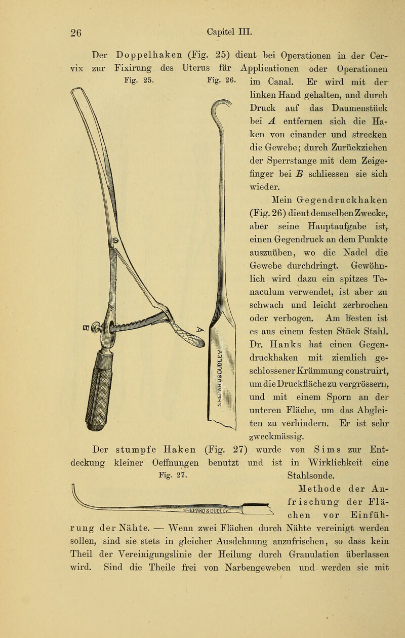 Der Doppelhaken (Fig. 25) dient bei Operationen in der Cer~ vix zur Fixirung des Uterus für Applicationen oder Operationen F'g- 25- FiS- 26- im Canal. Er wird mit der linken Hand gehalten, und durch Druck auf das Daumenstück bei A entfernen sich die Ha- ken von einander und strecken die Gewebe; durch Zurückziehen der Sperrstange mit dem Zeige- finger bei B schliessen sie sich wieder. Mein Gregendruckhaken (Fig. 26) dient demselben Zwecke^ aber seine Hauptaufgabe ist,, einen Gregendruck an dem Punkte auszuüben, wo die Nadel die Gfewebe durchdringt. Gewöhn- lich wird dazu ein spitzes Te- naculum verwendet, ist aber zu schwach und leicht zerbrochen oder verbogen. Am besten ist es aus einem festen Stück StahL Dr. Hanks hat einen Gfegen- druckhaken mit ziemlich ge- schlossener Krümmung construirt, um die Druckfläche zu vergrössern, und mit einem Sporn an der unteren Fläche, um das Abglei- ten zu verhindern. Er ist sehr zweckmässig. Der stumpfe Haken (Fig. 27) wurde von Sims zur Ent- deckung kleiner Oeffnungen benutzt und ist in Wirklichkeit eine Fig. 27. Stahlsonde. Methode der An- frischung der Flä- Einfüh- chen vor rung der Nähte. — Wenn zwei Flächen durch Nähte vereinigt werden sollen, sind sie stets in gleicher Ausdehnung anzufrischen, so dass kein Theil der Vereinigungslinie der Heilung durch Granidation überlassen wird. Sind die Theile frei von Narbengeweben und werden sie mit