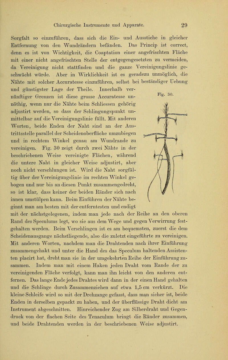 Fig. 30. Sorgfalt so einzuführen, dass sich die Ein- und Ausstiche in gleicher Entfernung von den Wundrändern befänden. Das Princip ist correct, denn es ist von Wichtigkeit, die Coaptation einer angefrischten Fläche mit einer nicht angefrischten Stelle der entgegengesetzten zu vermeiden, da Vereinigung nicht stattfinden und die ganze Vereinigungslinie ge- schwächt würde. Aber in Wirklichkeit ist es geradezu unmöglich, die Nähte mit solcher Accuratesse einzuführen, selbst bei beständiger Uebung und günstigster Lage der Theile. Innerhalb ver- nünftiger Grenzen ist diese grosse Accuratesse un- nöthig, wenn nur die Nähte beim Schliessen gehörig adjustirt werden, so dass der Schlingungspunkt un- mittelbar auf die Vereinigungslinie fällt. Mit anderen Worten, beide Enden der Naht sind an der Aus- trittsstelle parallel der Scheidenoberfläche umzubiegen und in rechtem Winkel genau am Wundrande zu vereinigen. Fig. 30 zeigt durch zwei Nähte in der beschriebenen Weise vereinigte Flächen, während die untere Naht in gleicher Weise adjustirt, aber noch nicht verschlungen ist. Wird die Naht sorgfäl- tig über der Vereinigungslinie im rechten Winkel ge- bogen und nur bis an diesen Punkt zusammengedreht, so ist klar, dass keiner der beiden Bänder sich nach innen umstülpen kann. Beim Einführen der Nähte be- ginnt man am besten mit der entferntesten und endigt mit der nächstgelegenen, indem man jede nach der Reihe an den oberen Eand des Speculums legt, wo sie aus dem Wege und gegen Verwirrung fest- gehalten werden. Beim Verschlingen ist es am bequemsten, zuerst die dem Scheidenausgange nächstliegende, also die zuletzt eingeführte zu vereinigen. Mit anderen Worten, nachdem man die Drahtenden nach ihrer Einführung zusammengehakt und unter die Hand des das Speculum haltenden Assisten- ten placirt hat, dreht man sie in der umgekehrten Beihe der Einführung zu- sammen. Indem man mit einem Haken jeden Draht vom Bande der zu vereinigenden Fläche verfolgt, kann man ihn leicht von den anderen ent- fernen. Das lange Ende jedes Drahtes wird dann in der einen Hand gehalten und die Schlinge durch Zusammenziehen auf etwa 1,5 cm verkürzt. Die kleine Schleife wird so mit der Drehzange gefasst, dass man sicher ist, beide Enden in derselben gepackt zu haben, und der überflüssige Draht dicht am Instrument abgeschnitten. Hinreichender Zug am Silberdraht uud Gregen- druck von der flachen Seite des Tenaculum bringt die Bänder zusammen, und beide Drahtenden werden in der beschriebenen Weise adjustirt.