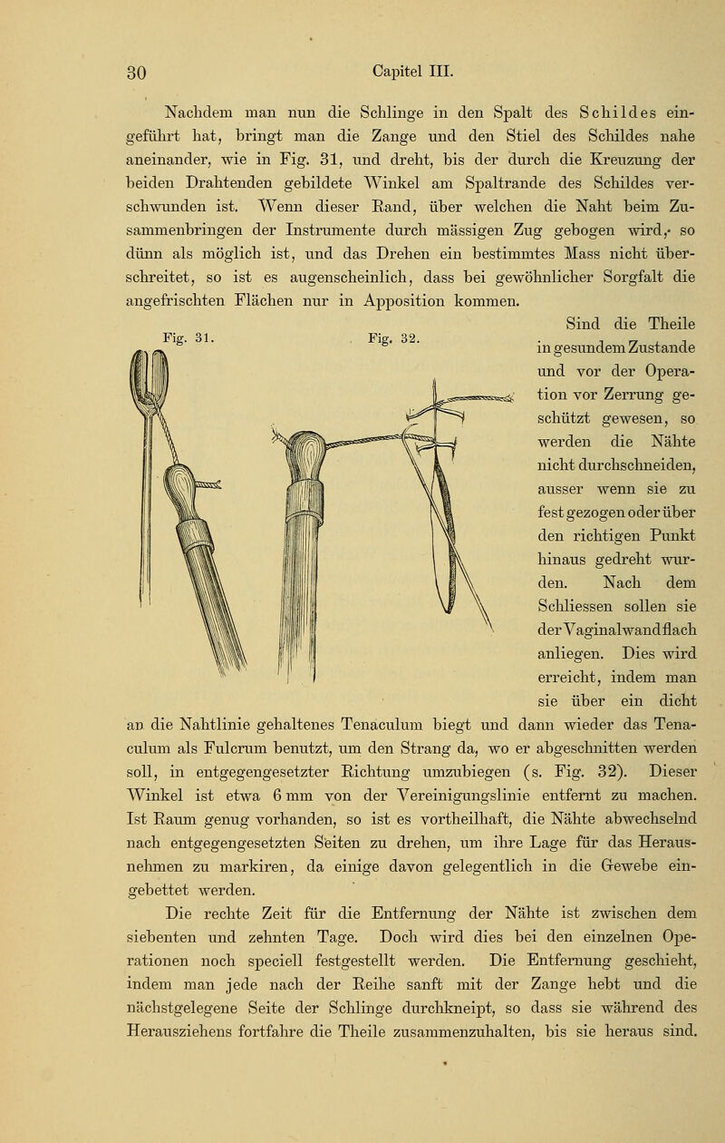 Nachdem man nun die Schlinge in den Spalt des Schildes ein- geführt hat, bringt man die Zange und den Stiel des Schildes nahe aneinander, wie in Fig. 31, und dreht, bis der durch die Kreuzung der beiden Drahtenden gebildete Winkel am Spaltrande des Schildes ver- schwunden ist. Wenn dieser Eand, über welchen die Naht beim Zu- sammenbringen der Instrumente durch massigen Zug gebogen wird,- so dünn als möglich ist, und das Drehen ein bestimmtes Mass nicht über- schreitet, so ist es augenscheinlich, dass bei gewöhnlicher Sorgfalt die angefrischten Flächen nur in Apposition kommen. Sind die Theile Fig. 31. . Fig. 32. . , „ , m gesundem Zustande und vor der Opera- tion vor Zerrung ge- schützt gewesen, so werden die Nähte nicht durchschneiden, ausser wenn sie zu fest gezogen oder über den richtigen Punkt hinaus gedreht wur- den. Nach dem \f \ Schliessen sollen sie der Vaginalwandflach anliegen. Dies wird erreicht, indem man sie über ein dicht ari die Nahtlinie gehaltenes Tenaculum biegt und dann wieder das Tena- culum als Fulcrum benutzt, um den Strang da, wo er abgeschnitten werden soll, in entgegengesetzter Richtung umzubiegen (s. Fig. 32). Dieser Winkel ist etwa 6 mm von der Vereinigungslinie entfernt zu machen. Ist Raum genug vorhanden, so ist es vortheilhaft, die Nähte abwechselnd nach entgegengesetzten Seiten zu drehen, um ihre Lage für das Heraus- nehmen zu markiren, da einige davon gelegentlich in die Grewebe ein- gebettet werden. Die rechte Zeit für die Entfernung der Nähte ist zwischen dem siebenten und zehnten Tage. Doch wird dies bei den einzelnen Ope- rationen noch speciell festgestellt werden. Die Entfernung geschieht, indem man jede nach der Reihe sanft mit der Zange hebt und die nächstgelegene Seite der Schlinge durchkneipt, so dass sie während des Herausziehens fortfahre die Theile zusammenzuhalten, bis sie heraus sind.