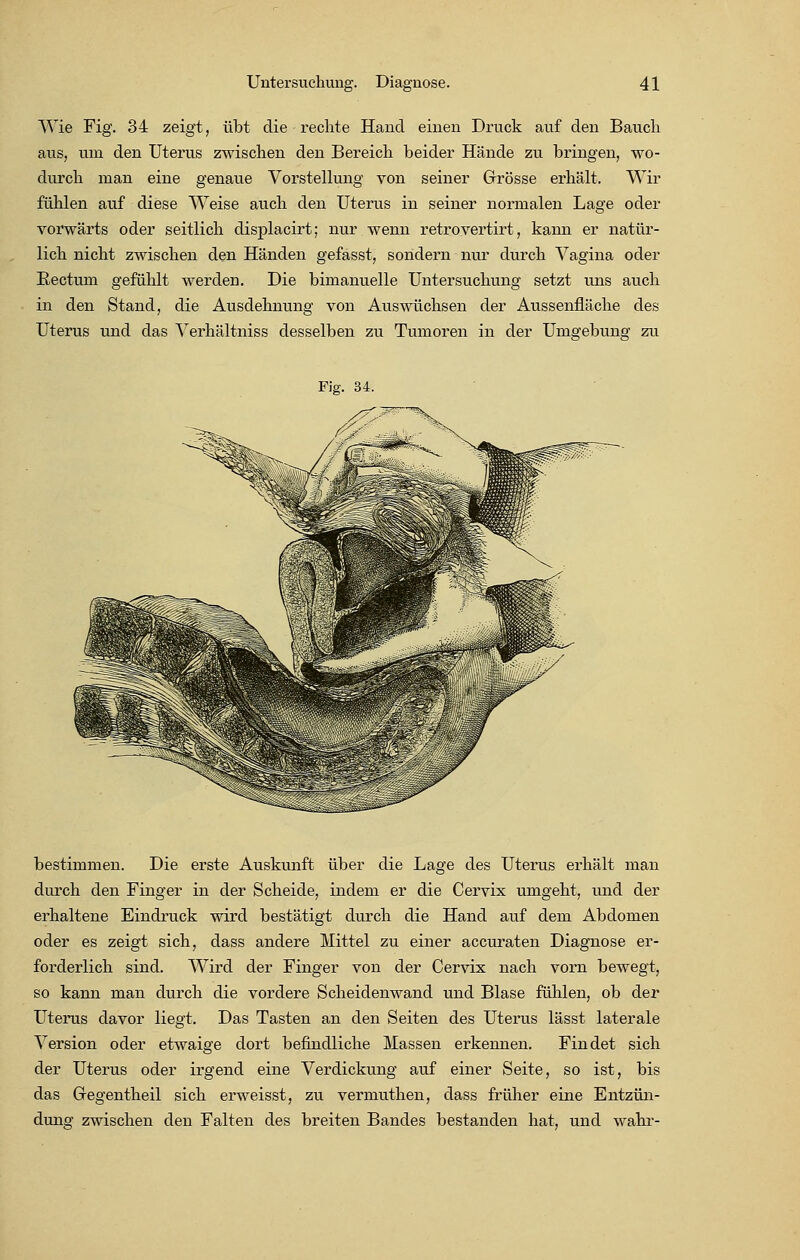 Wie Fig. 34 zeigt, übt die rechte Hand einen Druck auf den Bauch aus, um den Uterus zwischen den Bereich beider Hände zu bringen, wo- durch man eine genaue Vorstellung von seiner Grösse erhält. Wir fühlen auf diese Weise auch den Uterus in seiner normalen Lage oder vorwärts oder seitlich displacirt; nur wenn retrovertirt, kann er natür- lich nicht zwischen den Händen gefasst, sondern nur durch Vagina oder Rectum gefühlt werden. Die bimanuelle Untersuchung setzt uns auch in den Stand, die Ausdehnung von Auswüchsen der Aussenfläche des Uterus und das Verhältniss desselben zu Tumoren in der Umgebung zu bestimmen. Die erste Auskunft über die Lage des Uterus erhält man durch den Finger in der Scheide, indem er die Cervix umgeht, und der erhaltene Eindruck wird bestätigt durch die Hand auf dem Abdomen oder es zeigt sich, dass andere Mittel zu einer accuraten Diagnose er- forderlich sind. Wird der Finger von der Cervix nach vorn bewegt, so kann man durch die vordere Scheidenwand und Blase fühlen, ob der Uterus davor liegt. Das Tasten an den Seiten des Uterus lässt laterale Version oder etwaige dort befindliche Massen erkennen. Findet sich der Uterus oder irgend eine Verdickung auf einer Seite, so ist, bis das Gregentheil sich erweisst, zu vermuthen, dass früher eine Entzün- dung zwischen den Falten des breiten Bandes bestanden hat, und wahr-