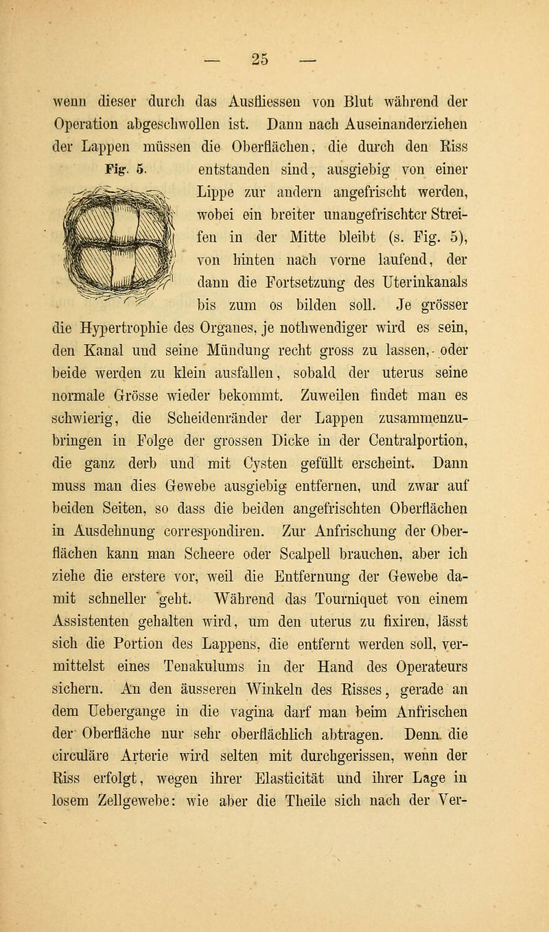 wenn dieser durch das Ausfliessen von Blut während der Operation abgeschwollen ist. Dann nach Auseinanderziehen der Lappen müssen die Oberflächen, die durch den Kiss Fig. 5. entstanden sind, ausgiebig von einer Lippe zur andern angefrischt werden, wobei ein breiter unangefrischtcr Strei- fen in der Mitte bleibt (s. Fig. 5), von hinten nach vorne laufend, der dann die Fortsetzung des Uterinkanals bis zum os bilden soll. Je grösser die Hypertrophie des Organes, je notwendiger wird es sein, den Kanal und seine Mündung recht gross zu lassen,-oder beide werden zu klein ausfallen, sobald der uterus seine normale Grösse wieder bekommt. Zuweilen findet man es schwierig, die Scheidenränder der Lappen zusammenzu- bringen iu Folge der grossen Dicke in der Centralportion, die ganz derb und mit Cysten gefüllt erscheint. Dann muss man dies Gewebe ausgiebig entfernen, und zwar auf beiden Seiten, so dass die beiden angefrischten Oberflächen in Ausdehnung correspondiren. Zur Anfrischung der Ober- flächen kann man Scheere oder Scalpell brauchen, aber ich ziehe die erstere vor, weil die Entfernung der Gewebe da- mit schneller geht. Während das Tourniquet von einem Assistenten gehalten wird, um den uterus zu fixiren, lässt sich die Portion des Lappens, die entfernt werden soll, ver- mittelst eines Tenakulums in der Hand des Operateurs sichern. An den äusseren Winkeln des Risses, gerade an dem Uebergange in die vagina darf man beim Anfrischen der Oberfläche nur sehr oberflächlich abtragen. Denn, die circuläre Arterie wird selten mit durchgerissen, wenn der Riss erfolgt, wegen ihrer Elasticität und ihrer Lage in losem Zellgewebe: wie aber die Theile sich nach der Ver-