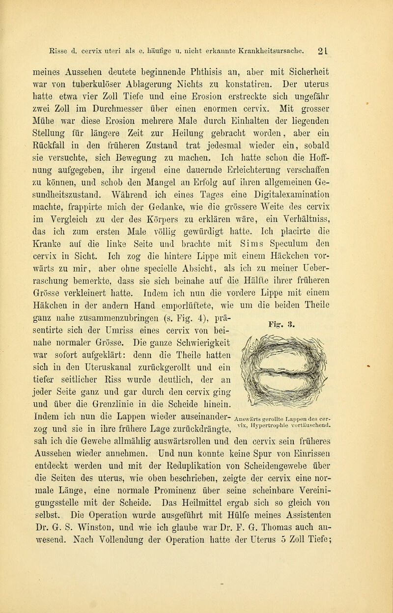 meines Aussehen deutete beginnende Phthisis an, aber mit Sicherheit war von tuberkulöser Ablagerung Nichts zu konstatiren. Der uterus hatte etwa vier Zoll Tiefe und eine Erosion erstreckte sich ungefähr zwei Zoll im Durchmesser über einen enormen cervix. Mit grosser Mühe war diese Erosion mehrere Male durch Einhalten der liegenden Stellung für längere Zeit zur Heilung gebracht worden, aber ein Rückfall in den früheren Zustand trat jedesmal wieder ein, sobald sie versuchte, sich Bewegung zu machen. Ich hatte schon die Hoff- nung aufgegeben, ihr irgend eine dauernde Erleichterung verschaffen zu können, und schob den Mangel an Erfolg auf ihren allgemeinen Ge- sundheitszustand. Während icli eines Tages eine Digitalexamination machte, frappirte mich der Gedanke, wie die grössere Weite des cervix im Vergleich zu der des Körpers zu erklären wäre, ein Verhältniss, das ich zum ersten Male völlig gewürdigt hatte. Ich placirte die Kranke auf die linke Seite und brachte mit Sims Speculum den cervix in Sicht. Ich zog die hintere Lippe mit einem Häckchen vor- wärts zu mir, aber ohne specielle Absicht, als ich zu meiner Ueber- raschung bemerkte, dass sie sich beinahe auf die Hälfte ihrer früheren Grösse verkleinert hatte. Indem ich nun die vordere Lippe mit einem Häkchen in der andern Hand emporlüftete, wie um die beiden Theile ganz nahe zusammenzubringen (s. Fig. 4), prä- sentirte sich der Umriss eines cervix von bei- nahe normaler Grösse. Die ganze Schwierigkeit war sofort aufgeklärt: denn die Theile hatten sich in den Uteruskanal zurückgerollt und ein tiefer seitlicher Eiss wurde deutlich, der an jeder Seite ganz und gar durch den cervix ging und über die Grenzlinie in die Scheide hinein. Indem ich nun die Lappen wieder auseinander- Auswärts gerollte Lappen des cer- zog und sie in ihre frühere Lage zurückdrängte, vix' H^ertr°ehie vortäuschend. sah ich die Gewebe allmählig auswärtsrollen und den cervix sein früheres Aussehen wieder annehmen. Und nun konnte keine Spur von Einrissen entdeckt werden und mit der Reduplikation von Scheidengewebe über die Seiten des uterus, wie oben beschrieben, zeigte der cervix eine nor- male Länge, eine normale Prominenz über seine scheinbare Vereini- gungsstelle mit der Scheide. Das Heilmittel ergab sich so gleich von selbst. Die Operation wurde ausgeführt mit Hülfe meines Assistenten Dr. G. S. Winston, und wie ich glaube war Dr. F. G. Thomas auch an- wesend. Nach Vollendung der Operation hatte der Uterus 5 Zoll Tiefe;