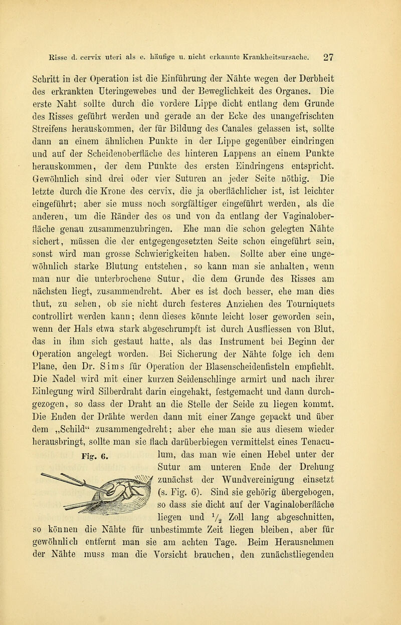 Schritt in der Operation ist die Einführung der Nähte wegen der Derbheit des erkrankten Uteringewebes und der Beweglichkeit des Organes. Die erste Naht sollte durch die vordere Lippe dicht entlang dem Grunde des Eisses geführt werden und gerade an der Ecke des unangefrischten Streifens herauskommen, der für Bildung des Canales gelassen ist, sollte dann an einem ähnlichen Punkte in der Lippe gegenüber eindringen und auf der Scheidenoberfläche des hinteren Lappens an einem Punkte herauskommen, der dem Punkte des ersten Eindringens entspricht. Gewöhnlich sind drei oder vier Suturen an jeder Seite nöthig. Die letzte durch die Krone des cervix, die ja oberflächlicher ist, ist leichter eingeführt; aber sie muss noch sorgfältiger eingeführt werden, als die anderen, um die Bänder des os und von da entlang der Vaginalober- fläche genau zusammenzubringen. Ehe man die schon gelegten Nähte sichert, müssen die der entgegengesetzten Seite schon eingeführt sein, sonst wird man grosse Schwierigkeiten haben. Sollte aber eine unge- wöhnlich starke Blutung entstehen, so kann man sie anhalten, wenn man nur die unterbrochene Sutur, die dem Grunde des Bisses am nächsten liegt, zusammendreht. Aber es ist doch besser, ehe man dies thut, zu sehen, ob sie nicht durch festeres Anziehen des Tourniquets controllirt werden kann; denn dieses könnte leicht loser geworden sein, wenn der Hals etwa stark abgeschrumpft ist durch Ausfiiessen von Blut, das in ihm sich gestaut hatte, als das Instrument bei Beginn der Operation angelegt worden. Bei Sicherung der Nähte folge ich dem Plane, den Dr. Sims für Operation der Blasenscheidenfisteln empfiehlt. Die Nadel wird mit einer kurzen Seidenschlinge armirt und nach ihrer Einlegung wird Silberdraht darin eingehakt, festgemacht und dann durch- gezogen, so dass der Draht an die Stelle der Seide zu liegen kommt. Die Enden der Drähte werden dann mit einer Zange gepackt und über dem „Schild zusammengedreht; aber ehe man sie aus diesem wieder herausbringt, sollte man sie flach darüberbiegen vermittelst eines Tenacu- Fig.. 6. lurn, das man wie einen Hebel unter der Sutur am unteren Ende der Drehung w zunächst der Wundvereinigung einsetzt (s. Fig. 6). Sind sie gehörig übergebogen, so dass sie dicht auf der Vaginaloberfiäche liegen und V2 Zoll lang abgeschnitten, so können die Nähte für unbestimmte Zeit liegen bleiben, aber für gewöhnlich entfernt man sie am achten Tage. Beim Herausnehmen der Nähte muss man die Vorsicht brauchen, den zunächstliegenden