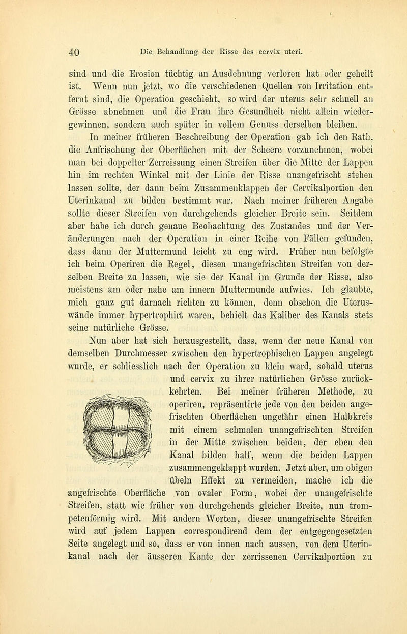 sind und die Erosion tüchtig an Ausdehnung verloren hat oder geheilt ist. Wenn nun jetzt, wo die verschiedenen Quellen von Irritation ent- fernt sind, die Operation geschieht, so wird der uterus sehr schnell an Grösse abnehmen und die Frau ihre Gesundheit nicht allein wieder- gewinnen, sondern auch später in vollem Genuss derselben bleiben. In meiner früheren Beschreibimg der Operation gab ich den Kath, die Anfrischung der Oberflächen mit der Scheere vorzunehmen, wobei man bei doppelter Zerreissung einen Streifen über die Mitte der Lappen hin im rechten Winkel mit der Linie der Eisse unangefrischt stehen lassen sollte, der dann beim Zusammenklappen der Cervikalportion den Uterinkanal zu bilden bestimmt war. Nach meiner früheren Angabe sollte dieser Streifen von durchgehends gleicher Breite sein. Seitdem aber habe ich durch genaue Beobachtung des Zustandes und der Ver- änderungen nach der Operation in einer Keihe von Fällen gefunden, dass dann der Muttermund leicht zu eng wird. Früher nun befolgte ich beim Operiren die Eegel, diesen unangefrischten Streifen von der- selben Breite zu lassen, wie sie der Kanal im Grunde der Bisse, also meistens am oder nahe am innern Muttermunde aufwies. Ich glaubte, mich ganz gut darnach richten zu können, denn obschon die Uterus- wände immer hypertrophirt waren, behielt das Kaliber des Kanals stets seine natürliche Grösse. Nun aber hat sich herausgestellt, dass, wenn der neue Kanal von demselben Durchmesser zwischen den hypertrophischen Lappen angelegt wurde, er schliesslich nach der Operation zu klein ward, sobald uterus und cervix zu ihrer natürlichen Grösse zurück- kehrten. Bei meiner früheren Methode, zu operiren, repräsentirte jede von den beiden ange- frischten Oberflächen ungefähr einen Halbkreis mit einem schmalen unangefrischten Streifen in der Mitte zwischen beiden, der eben den Kanal bilden half, wenn die beiden Lappen zusammengeklappt wurden. Jetzt aber, um obigen Übeln Effekt zu vermeiden, mache ich die angefrischte Oberfläche von ovaler Form, wobei der unangefrischte Streifen, statt wie früher von durchgehends gleicher Breite, nun trom- petenförmig wird. Mit andern Worten, dieser unangefrischte Streifen wird auf jedem Lappen correspondirend dem der entgegengesetzten Seite angelegt und so, dass er von innen nach aussen, von dem Uterin- kanal nach der äusseren Kante der zerrissenen Cervikalportion zu