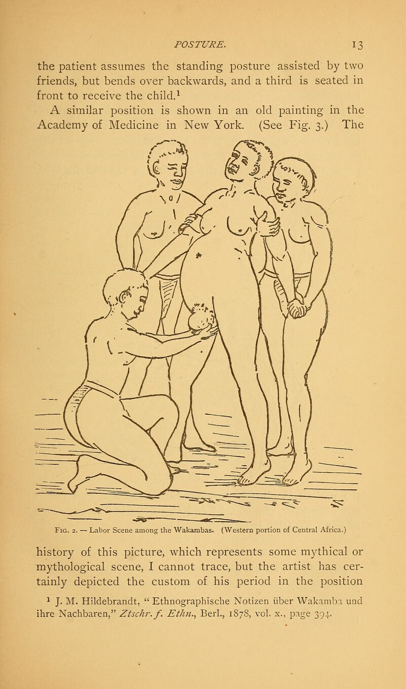 the patient assumes the standing posture assisted by two friends, but bends over backwards, and a third is seated in front to receive the child.^ A similar position is shown in an old painting in the Academy of Medicine in New York, (See Fig. 3.) The Fig. 2. — Labor Scene among the Wakambas. (Western portion of Central Africa.) history of this picture, which represents some mythical or mythological scene, I cannot trace, but the artist has cer- tainly depicted the custom of his period in the position ^ J. M. Hildebrandt,  Ethnographische Notizen iiber Wakamba und ihre Nachbaren, Ztschr.f. Ethn., Berl., 1S78, vol. x., page 394.