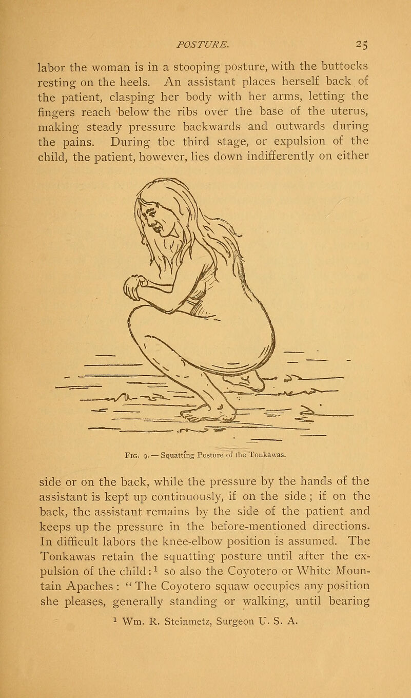 labor the woman is in a stooping posture, with the buttocks resting on the heels. An assistant places herself back of the patient, clasping her body with her arms, letting the fingers reach below the ribs over the base of the uterus, making steady pressure backwards and outwards during the pains. During the third stage, or expulsion of the child, the patient, however, lies down indifferently on either Fig. 9. — Squatt'ng Posture of the Tonkawas. side or on the back, while the pressure by the hands of the assistant is kept up continuously, if on the side ; if on the back, the assistant remains by the side of the patient and keeps up the pressure in the before-mentioned directions. In difficult labors the knee-elbow position is assumed. The Tonkawas retain the squatting posture until after the ex- pulsion of the child :i so also the Coyotero or White Moun- tain Apaches : The Coyotero squaw occupies any position she pleases, generally standing or walking, until bearing 1 Wm. R. Steinmetz, Surgeon U. S. A.