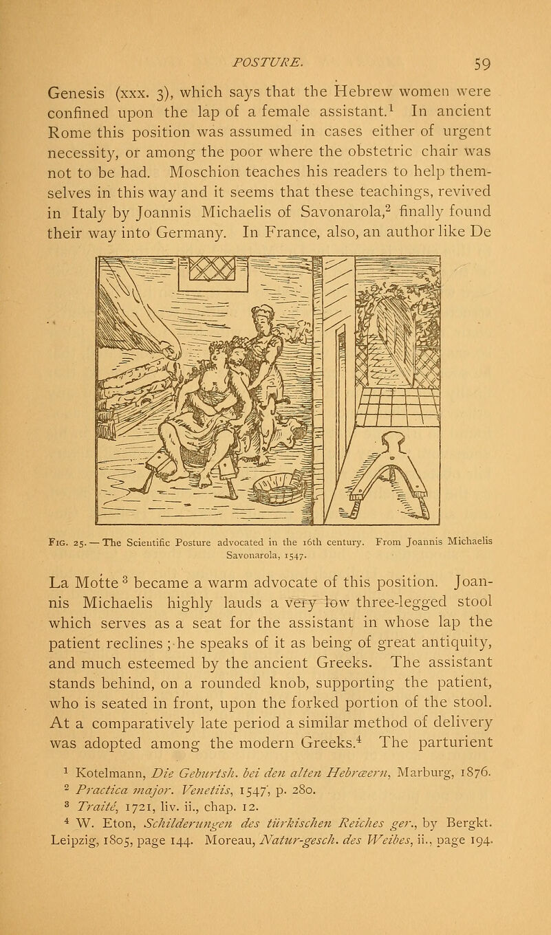 Genesis (xxx. 3), which says that the Hebrew women were confined upon the lap of a female assistant.^ In ancient Rome this position was assmned in cases either of urgent necessity, or among the poor where the obstetric chair was not to be had. Moschion teaches his readers to help them- selves in this way and it seems that these teachings, revived in Italy by Joannis Michaelis of Savonarola,^ finally found their way into Germany. In France, also, an author like De Fig. 25. — Tlie Scientific Posture advocated in the i6th century. From Joannis Michaelis Savonarola, 1547. La Motte ^ became a warm advocate of this position. Joan- nis Michaelis highly lauds a very low three-legged stool which serves as a seat for the assistant in whose lap the patient reclines ;he speaks of it as being of great antiquity, and much esteemed by the ancient Greeks. The assistant stands behind, on a rounded knob, supporting the patient, who is seated in front, upon the forked portion of the stool. At a comparatively late period a similar method of delivery was adopted among the modern Greeks.'' The parturient 1 Kotelmann, Die Gebiirtsh. bei den alien Hebraern, Marburg, 1876. 2 Practica major. Vettetiis, 1547', p. 280. ^ Tj'aiie, 1721, liv. ii., chap. 12. * W. Eton, ScJiilderungen des tiirkischen Reiches ger., by Bergkt. Leipzig, 1805, page 144. Moreau, Natur-gesch. des Weibes, ii., page 194.