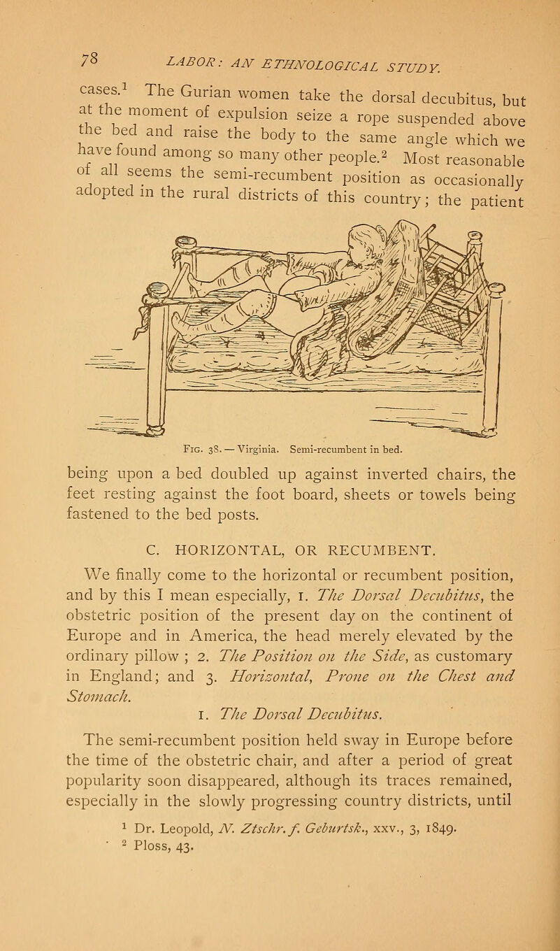 cases. The Gunan women take the dorsal decubitus but at the moment of expulsion seize a rope suspended above the bed and raise the body to the same angle which we have found among so many other people.^ Most reasonable ot all seems the semi-recumbent position as occasionally adopted m the rural districts of this country; the patient Fig. 3S. — Virginia. Seml-recumbent in bed. being upon a bed doubled up against inverted chairs, the feet resting against the foot board, sheets or towels being fastened to the bed posts. C. HORIZONTAL, OR RECUMBENT. We finally come to the horizontal or recumbent position, and by this I mean especially, i. The Dorsal Decubitus, the obstetric position of the present day on the continent of Europe and in America, the head merely elevated by the ordinary pillow ; 2. TJie Position on the Side, as customary in England; and 3. Horizontal, Prone on the Chest and Stomach. I. The Dorsal Dec7ibitus. The semi-recumbent position held sway in Europe before the time of the obstetric chair, and after a period of great popularity soon disappeared, although its traces remained, especially in the slowly progressing country districts, until 1 Dr. Leopold, N. Ztschr.f. Geburtsk., xxv., 3, 1849. ■ 2 Ploss, 43.