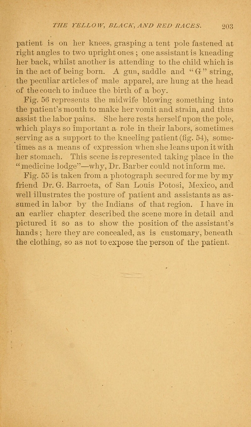 patient is on her knees, grasping a tent pole fastened at right angles to two upright ones ; one assistant is kneading her back, whilst another is attending to the child which is in the act of being born. A gun, saddle and Gr string, the peculiar articles of male apparel, are hung at the head of the couch to induce the birth of a boy. Fig. 56 represents the midwife blowing something into the patient's mouth to make her vomit and strain, and thus assist the labor pains. She here rests herself upon the pole, which plays so important a role in their labors, sometimes serving as a support to the kneeling patient (fig. 54), some- times as a means of expression when she leans upon it with her stomach. This scene is represented taking place in the medicine lodge—why. Dr. Barber could not inform me. Fig. 55 is taken from a photograph secured for me by my friend Dr. G. Barroeta, of San Louis Potosi, Mexico, and well illustrates the posture of patient and assistants as as- sumed in labor by the Indians of that region. I have in an earlier chapter described the scene more in detail and pictured it so as to show the position of the assistant's hands ; here they are concealed, as is customary, beneath the clothing, so as not to expose the person of the patient.