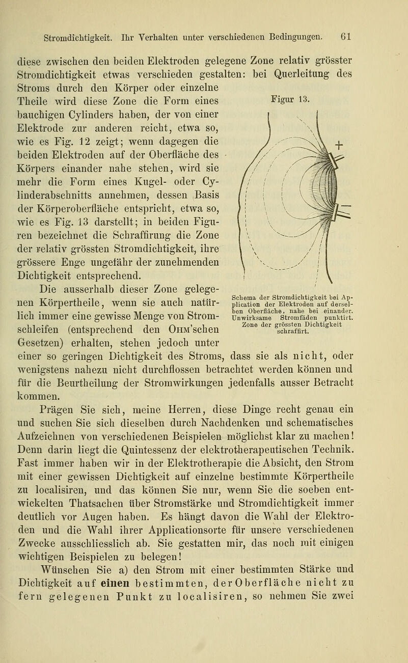 Figur 13. diese zwischen den beiden Elektroden gelegene Zone relativ grösster Stromdichtigkeit etwas verschieden gestalten: bei Querleitung des Stroms durch den Körper oder einzelne Theile wird diese Zone die Form eines bauchigen Cylinders haben, der von einer Elektrode zur anderen reicht, etwa so, wie es Fig. 12 zeigt; wenn dagegen die beiden Elektroden auf der Oberfläche des Körpers einander nahe stehen, wird sie mehr die Form eines Kugel- oder Cj- linderabschnitts annehmen, dessen ,Basis der Körperoberfläche entspricht, etwa so, wie es Fig. 13 darstellt; in beiden Figu- ren bezeichnet die Schraffirung die Zone der relativ grössten Stromdichtigkeit, ihre grössere Enge ungefähr der zunehmenden Dichtigkeit entsprechend. Die ausserhalb dieser Zone gelege- nen Körpertheile, wenn sie auch natür- lich immer eine gewisse Menge von Strom- schleifen (entsprechend den OnM'schen Gesetzen) erhalten, stehen jedoch unter einer so geringen Dichtigkeit des Stroms, dass sie als nicht, oder wenigstens nahezu nicht durchflössen betrachtet werden können und für die Beurtheilung der Stromwirkungen jedenfalls ausser Betracht kommen. Prägen Sie sich, meine Herren, diese Dinge recht genau ein und suchen Sie sich dieselben durch Nachdenken und schematisches Aufzeichnen von verschiedenen Beispielen möglichst klar zu machen! Denn darin liegt die Quintessenz der elektrotherapeutischen Technik. Fast immer haben wir in der Elektrotherapie die Absicht, den Strom mit einer gewissen Dichtigkeit auf einzelne bestimmte Körpertheile zu localisiren, und das können Sie nur, wenn Sie die soeben ent- wickelten Thatsachen über Stromstärke und Stromdichtigkeit immer deutlich vor Augen haben. Es hängt davon die Wahl der Elektro- den und die Wahl ihrer Applicationsorte für unsere verschiedenen Zwecke ausschliesslich ab. Sie gestatten mir, das noch mit einigen wichtigen Beispielen zu belegen! Wünschen Sie a) den Strom mit einer bestimmten Stärke und Dichtigkeit auf einen bestimmten, der Oberfläche nicht zu fern gelegenen Punkt zu localisiren, so nehmen Sie zwei Schema der Stromdiclitiglceit hei Ap- plication der Elektroden auf dersel- hen Oherfläclie, nahe hei einander. Unwirksame Stromfäden punktirt. Zone der grössten Dichtigkeit schrafflrt.