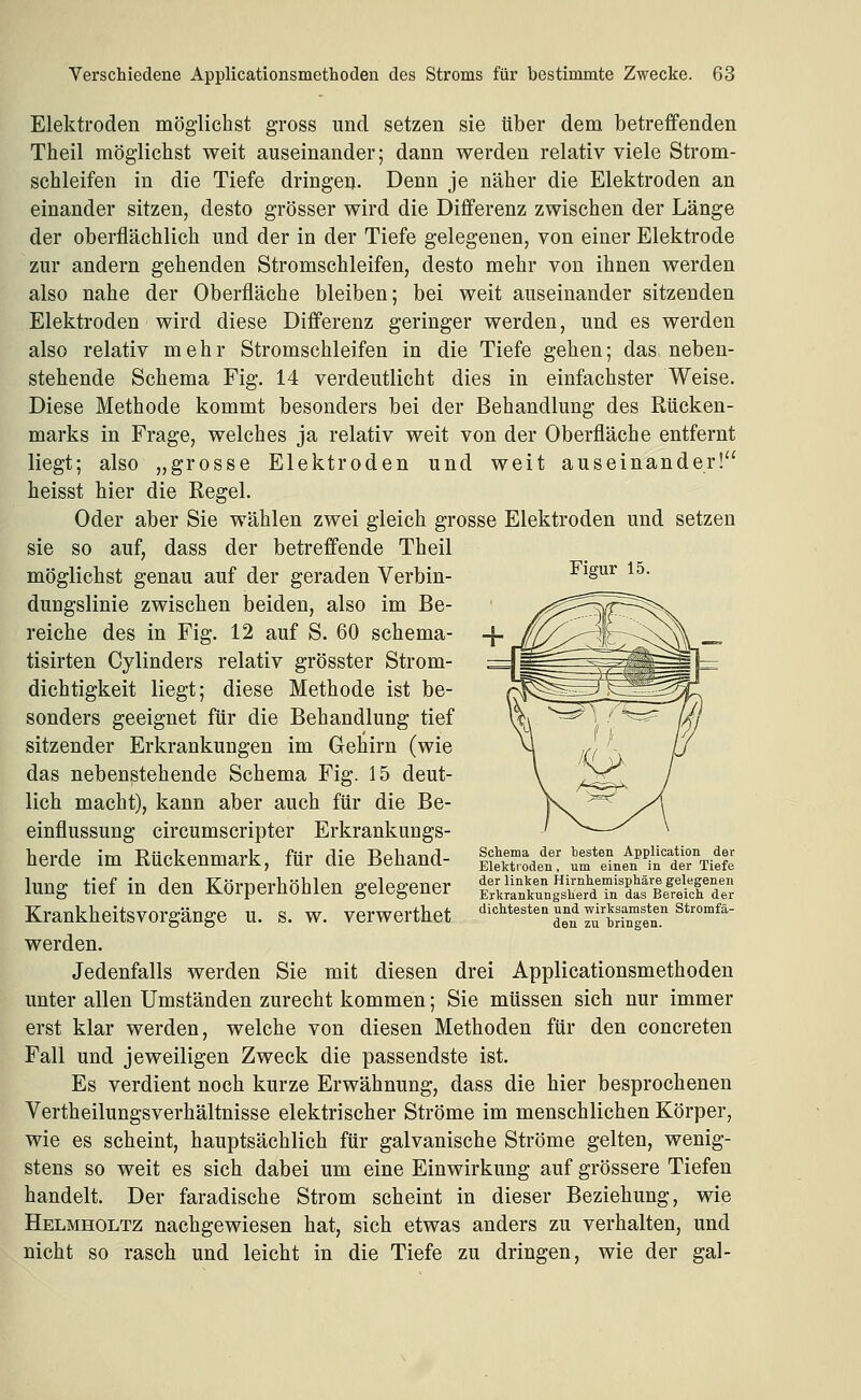 Figur 15. Elektroden möglichst gross und setzen sie über dem betreffenden Theil möglichst weit auseinander; dann werden relativ viele Strom- schleifen in die Tiefe dringeu. Denn je näher die Elektroden an einander sitzen, desto grösser wird die Differenz zwischen der Länge der oberflächlich und der in der Tiefe gelegenen, von einer Elektrode zur andern gehenden Stromschleifen, desto mehr von ihnen werden also nahe der Oberfläche bleiben; bei weit auseinander sitzenden Elektroden wird diese Differenz geringer werden, und es werden also relativ mehr Stromschleifen in die Tiefe gehen; das neben- stehende Schema Fig. 14 verdeutlicht dies in einfachster Weise. Diese Methode kommt besonders bei der Behandlung des Rücken- marks in Frage, welches ja relativ weit von der Oberfläche entfernt liegt; also „grosse Elektroden und weit auseinander! heisst hier die Eegel. Oder aber Sie wählen zwei gleich grosse Elektroden und setzen sie so auf, dass der betreffende Theil möglichst genau auf der geraden Verbin- dungslinie zwischen beiden, also im Be- reiche des in Fig. 12 auf S. 60 schema- tisirten Cylinders relativ grösster Strom- dichtigkeit liegt; diese Methode ist be- sonders geeignet für die Behandlung tief sitzender Erkrankungen im Gehirn (wie das nebenstehende Schema Fig. 15 deut- lich macht), kann aber auch für die Be- einflussung circumscripter Erkrankungs- herde im Rückenmark, für die Behand- lung tief in den Körperhöhlen gelegener Krankheitsvorgänge u. s. w. verwerthet werden. Jedenfalls werden Sie mit diesen drei Applicationsmethoden unter allen Umständen zurecht kommen; Sie müssen sich nur immer erst klar werden, welche von diesen Methoden für den concreten Fall und jeweiligen Zweck die passendste ist. Es verdient noch kurze Erwähnung, dass die hier besprochenen Vertheilungsverhältnisse elektrischer Ströme im menschlichen Körper, wie es scheint, hauptsächlich für galvanische Ströme gelten, wenig- stens so weit es sich dabei um eine Einwirkung auf grössere Tiefen handelt. Der faradische Strom scheint in dieser Beziehung, wie Helmholtz nachgewiesen hat, sich etwas anders zu verhalten, und nicht so rasch und leicht in die Tiefe zu dringen, wie der gal- Schema der besten Application der Elektroden, um einen in der Tiefe der linlcen Hirnh.emisphäre gelegenen Erkrankungslierd in das Bereich, der dichtesten und -wirksamsten Stromfä- den zu bringen.