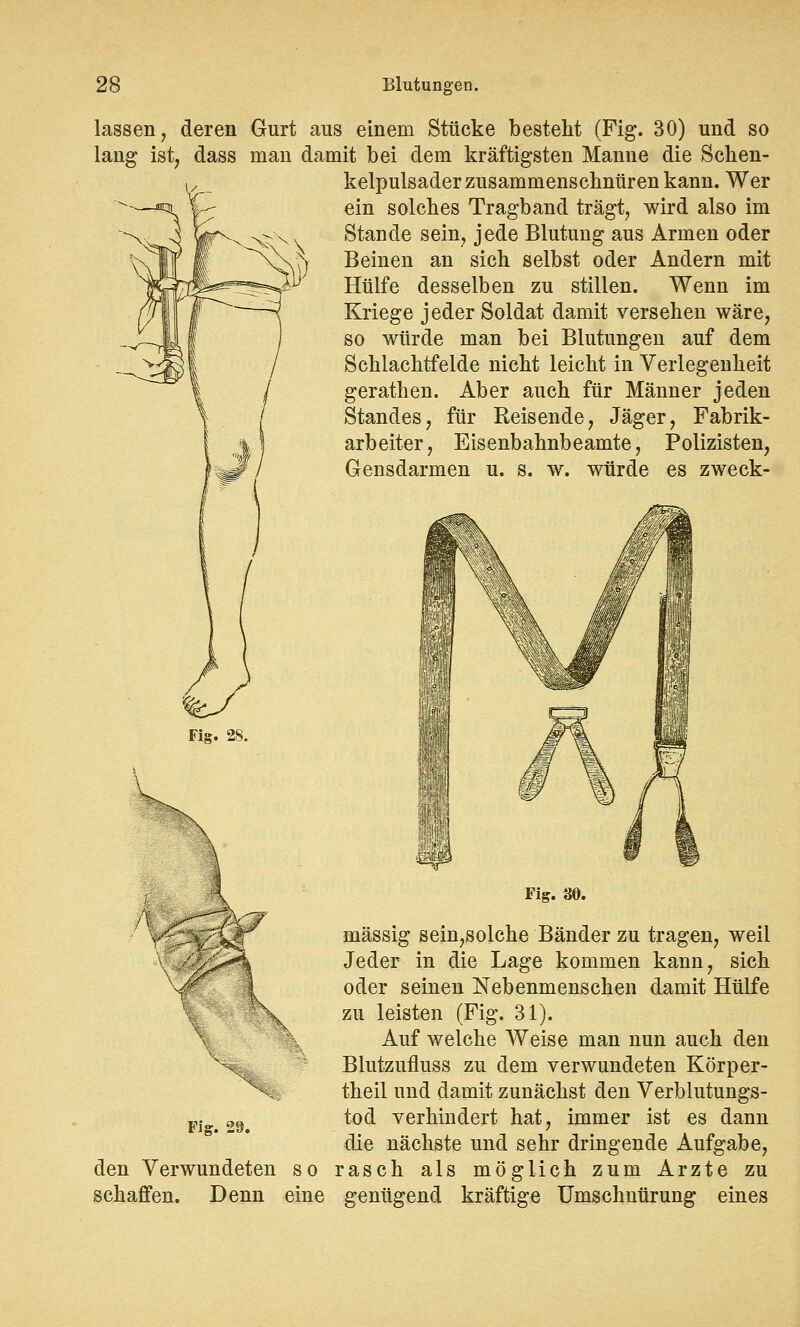 lassen, deren Gurt aus einem Stücke besteht (Fig. 30) und so lang ist, dass man damit bei dem kräftigsten Manne die Schen- kelpulsader zusammenschnüren kann. Wer ein solches Tragband trägt, wird also im Stande sein, jede Blutung aus Armen oder Beinen an sich selbst oder Andern mit Hülfe desselben zu stillen. Wenn im Kriege jeder Soldat damit versehen wäre, so würde man bei Blutungen auf dem Schlachtfelde nicht leicht in Verlegenheit gerathen. Aber auch für Männer jeden Standes, für Reisende, Jäger, Fabrik- arbeiter, Eisenbahnbeamte, Polizisten, Gensdarmen u. s. w. würde es zweck- Fig. 28. ^4 Fig. 29. Fig. 30. massig sein,solche Bänder zu tragen, weil Jeder in die Lage kommen kann, sich oder seinen Nebenmenschen damit Hülfe zu leisten (Fig. 31). Auf welche Weise man nun auch den Blutzufluss zu dem verwundeten Körper- theil und damit zunächst den Verblutungs- tod verhindert hat, immer ist es dann die nächste und sehr dringende Aufgabe, den Verwundeten so rasch als möglich zum Arzte zu schaffen. Denn eine genügend kräftige Umschnürung eines