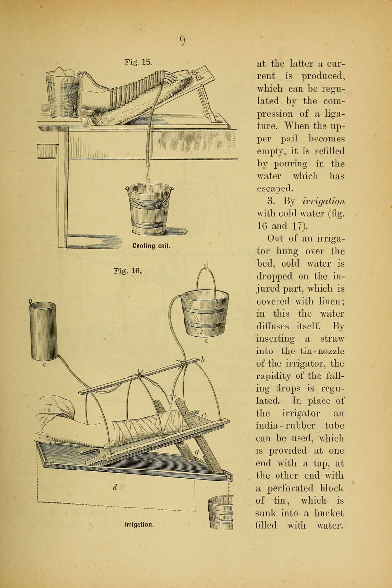 Irrigation. rent is produced, which can be regu- lated by the com- pression of a liga- ture. When the up- per pail becomes empty, it is refilled by pouring in the water which has escaped. 3. By irrigation with cold water (fig. 16 and 17). Out of an irriga- tor hung over the bed, cold water is dropped on the in- jured part, which is covered with linen; in this the water diffuses itself. By inserting a straw into the tin-nozzle of the irrigator, the rapidity of the fall- ing drops is regu- lated. In place of the irrigator an iudia - rubber tube can be used, which is provided at one end with a tap, at the other end with a perforated block of tin, which is sunk into a bucket filled with water.