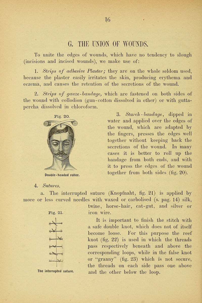 \6 G. THE UNION OF WOUNDS. To unite the edges of wounds, which have no tendency to slough (incisions and incised wounds), we make use of: 1. Strips of adhesive Plaster; they are on the whole seldom used, because the plaster easily irritates the skin, producing erythema and eczema, and causes the retention of the secretions of the wound. 2. Strips of gauze-bandage, which are fastened on both sides of the wound with collodion (gun-cotton dissolved in ether) or with gutta- percha dissolved in chloroform. 3. Starch - bandage, dipped in water and applied over the edges of the wound, which are adapted by the fingers, presses the edges well together without keeping back the secretions of the wound. In many cases it is better to roll up the bandage from both ends, and with it to press the edges of the wound Doubi^hea^oner. together from both sides (fig. 20). Pig. 20. Fig. 21. 4. Sutures. a. The interrupted suture (Knopfnaht, fig. 21) is applied by more or less curved needles with waxed or carbolised (s. pag. 14) silk, twine, horse-hair, cat-gut, and silver or iron wire. It is important to finish the stitch with a safe double knot, which does not of itself become loose. For this purpose the reef knot (fig. 22) is used in which the threads pass respectively beneath and above the corresponding loops, while in the false knot or granny (fig. 23) which is not secure, the threads on each side pass one above and the other below the loop. s——^£« \£. The interrupted suture.