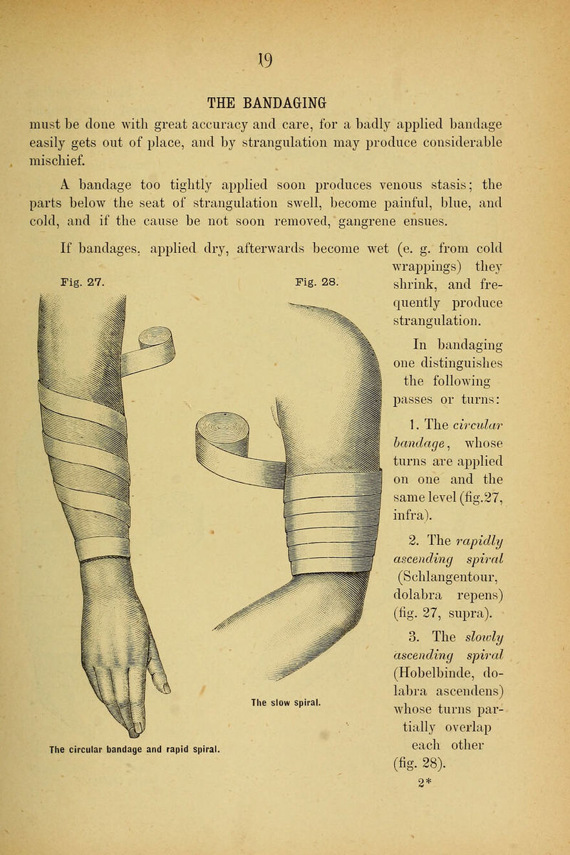 THE BANDAGING must be done with great accuracy and care, for a badly applied bandage easily gets out of place, and by strangulation may produce considerable mischief. A bandage too tightly applied soon produces venous stasis; the parts below the seat of strangulation swell, become painful, blue, and cold, and if the cause be not soon removed, gangrene ensues. If bandages, applied dry, afterwards become wet (e. g. from cold wrappings) they Fig. 27. Fig. 28. shrink, and fre- quently produce strangulation. In bandaging one distinguishes the following passes or turns: 1. The circular bandage, whose turns are applied on one and the same level (fig. 27, infra). 2. The rapidly ascending spiral (Schlangentour, dolabra repens) (fig. 27, supra). 3. The slowly ascending spiral (Hobelbinde, do- labra ascendens) whose turns par- tially overlap each other (fig. 28). 2* The slow spiral. The circular bandage and rapid spiral.