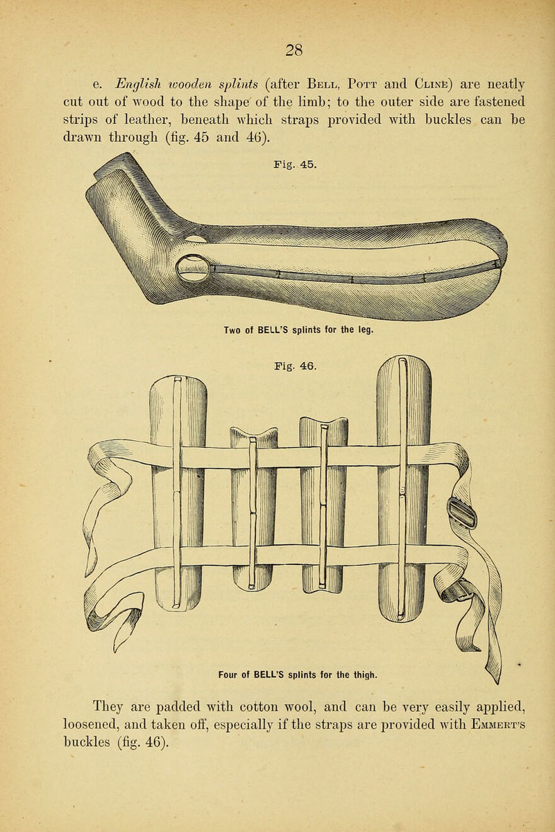 e. English wooden splints (after Bell, Pott and Cline) are neatly cut out of wood to the shape of the limb; to the outer side are fastened strips of leather, beneath which straps provided with buckles can be drawn through (fig. 45 and 46). Two of BELL'S splints for the leg. Four of BELL'S splints for the thigh They are padded with cotton wool, and can be very easily applied, loosened, and taken off, especially if the straps are provided with Emmert's buckles (fig. 46).