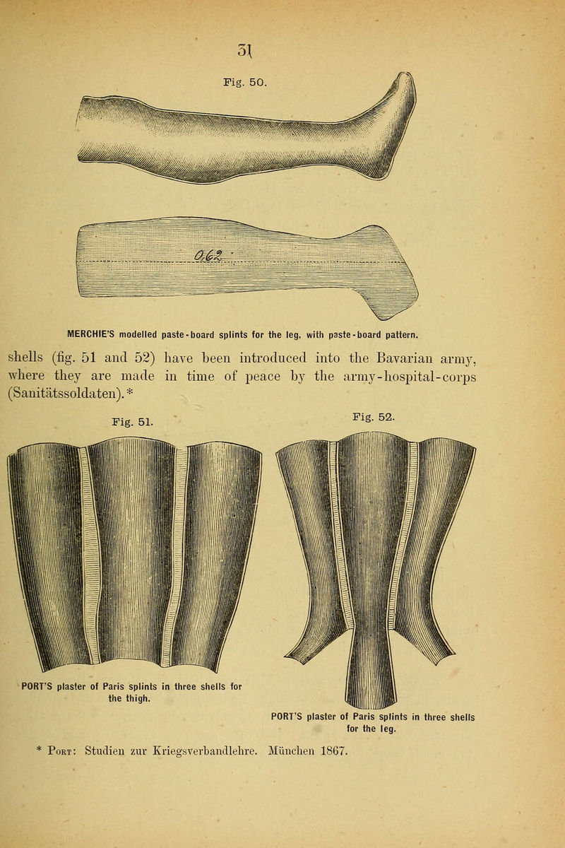 shells (fig. 51 and 52) have been introduced into the Bavarian army, where they are made in time of peace by the army-hospital-corps (Sanitatssoldaten). * Fig. 51. Fi«- 52- PORT'S plaster of Paris splints in three shells for the thigh. PORT'S plaster of Paris splints in three shells for the leg. * Port: Studien zur Krieg-sverbandlehre. Munchen 1867.