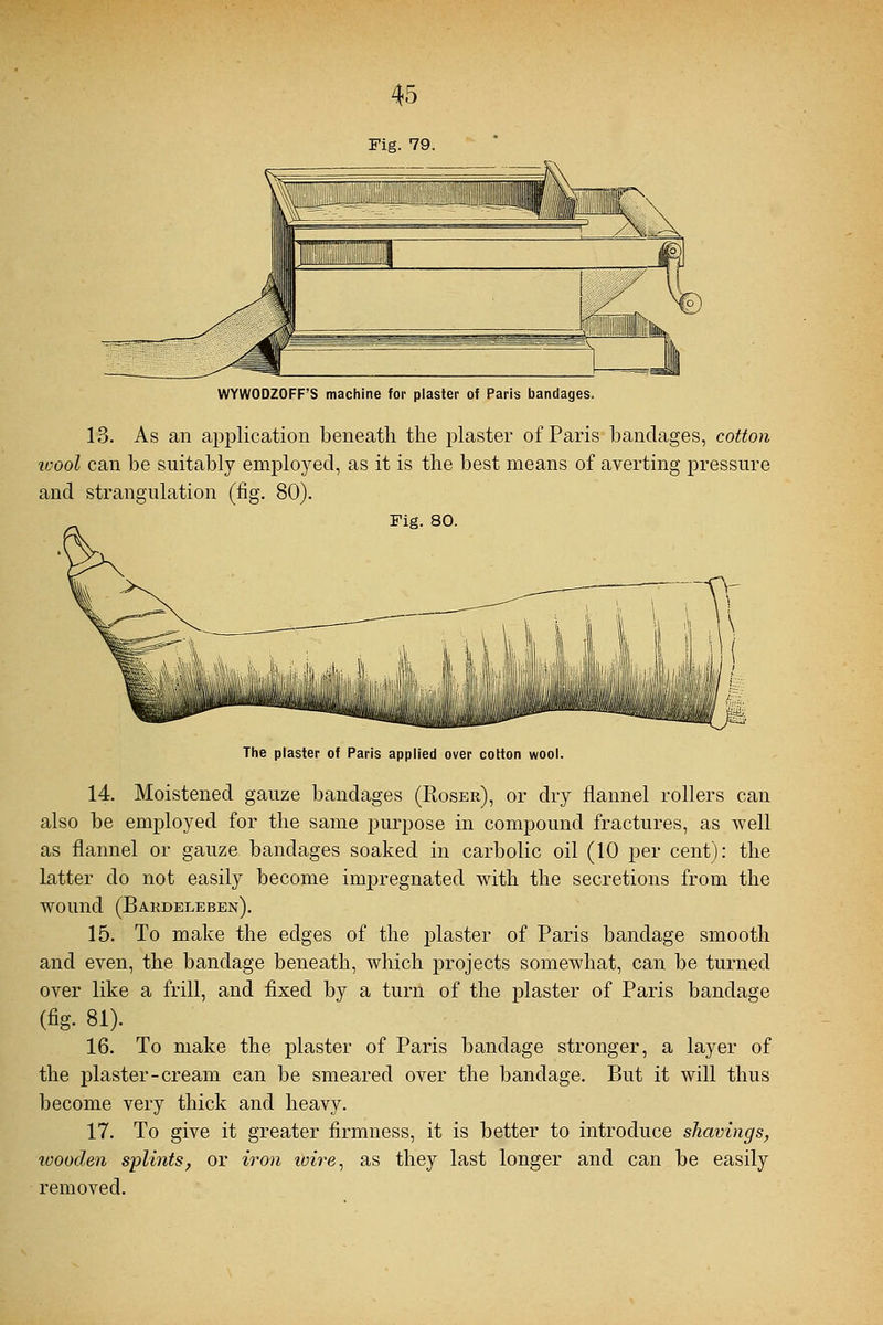 Fig. 79. WYWODZOFF'S machine for plaster of Paris bandages. 13. As an application beneath the plaster of Paris bandages, cotton icool can be suitably employed, as it is the best means of averting pressure and strangulation (fig. 80). Fig. 80. The plaster of Paris applied over cotton wool. 14. Moistened gauze bandages (Roser), or dry flannel rollers can also be employed for the same purpose in compound fractures, as well as flannel or gauze bandages soaked in carbolic oil (10 per cent): the latter do not easily become impregnated with the secretions from the wound (Bardeleben). 15. To make the edges of the plaster of Paris bandage smooth and even, the bandage beneath, which projects somewhat, can be turned over like a frill, and fixed by a turn of the plaster of Paris bandage (%. 81). 16. To make the plaster of Paris bandage stronger, a layer of the plaster-cream can be smeared over the bandage. But it will thus become very thick and heavy. 17. To give it greater firmness, it is better to introduce shavings, wooden splints, or iron icire, as they last longer and can be easily removed.