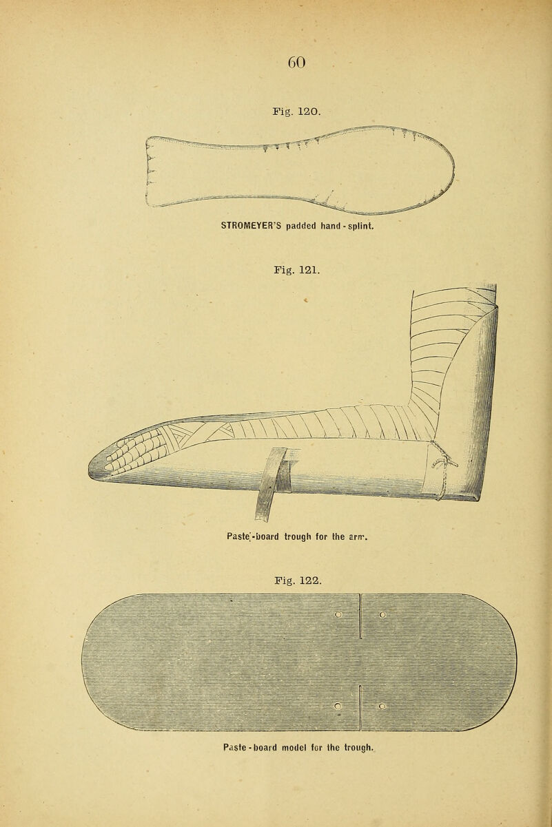 Fig. 120. STROMEYER'S padded hand-splint. Fig. 121. Paste'-board trough for the arn\ Fig. 122. Paste-board model for the trough.