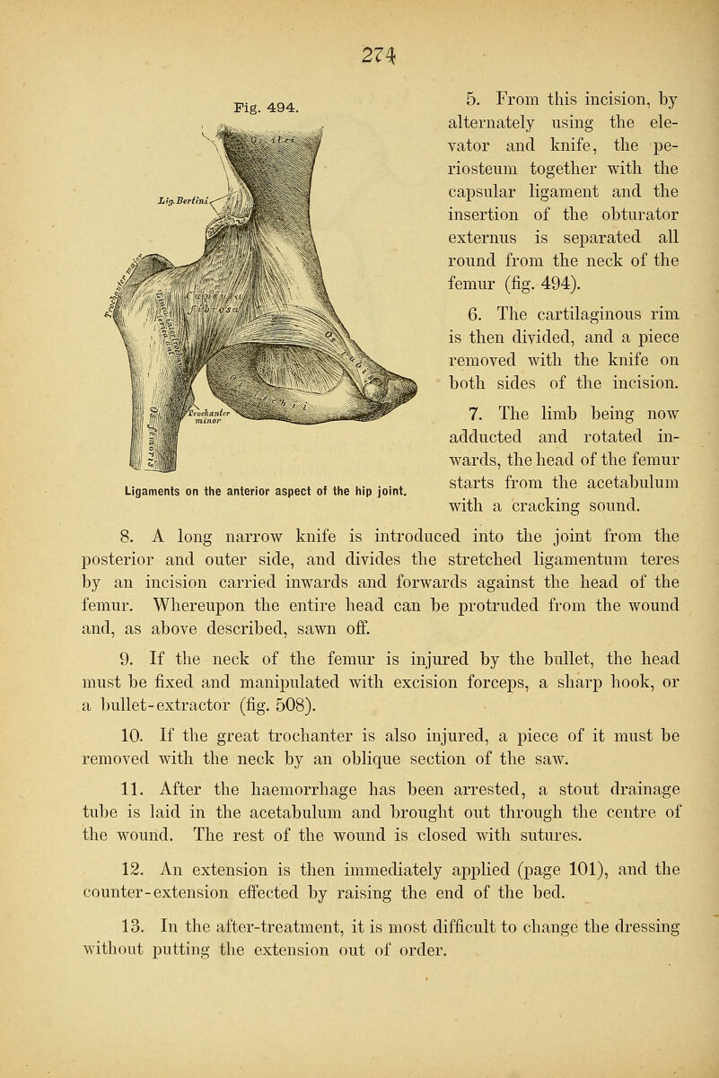 Fig. 494. Ligaments on the anterior aspect of the hip joint. 5. From this incision, by alternately using the ele- vator and knife, the pe- riosteum together with the capsular ligament and the insertion of the obturator externus is separated all round from the neck of the femur (fig. 494). 6. The cartilaginous rim is then divided, and a piece removed with the knife on both sides of the incision. 7. The limb being now adducted and rotated in- wards, the head of the femur starts from the acetabulum with a cracking sound. 8. A long narrow knife is introduced into the joint from the posterior and outer side, and divides the stretched ligamentum teres by an incision carried inwards and forwards against the head of the femur. Whereupon the entire head can be protruded from the wound and, as above described, sawn off. 9. If the neck of the femur is injured by the bullet, the head must be fixed and manipulated with excision forceps, a sharp hook, or a bullet-extractor (fig. 508). 10. If the great trochanter is also injured, a piece of it must be removed with the neck by an oblique section of the saw. 11. After the haemorrhage has been arrested, a stout drainage tube is laid in the acetabulum and brought out through the centre of the wound. The rest of the wound is closed with sutures. 12. An extension is then immediately applied (page 101), and the counter-extension effected by raising the end of the bed. 13. In the after-treatment, it is most difficult to change the dressing without putting the extension out of order.