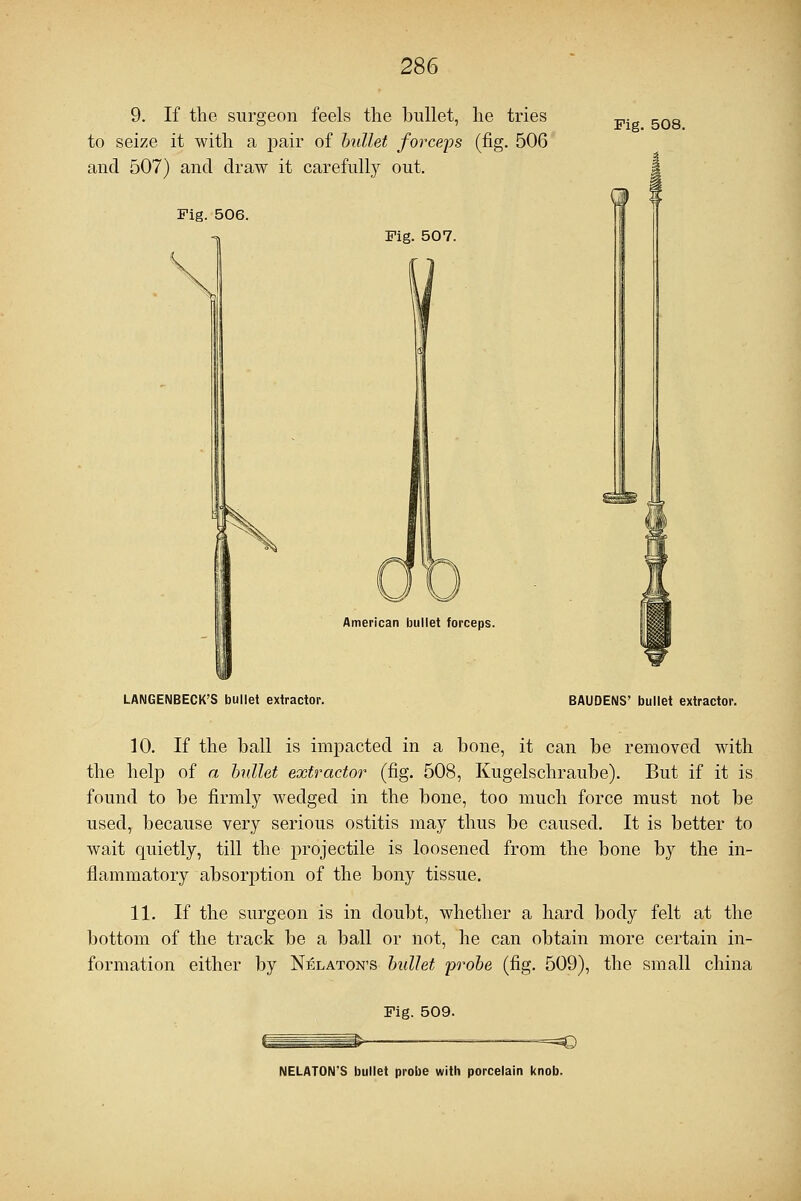 9. If the surgeon feels the bullet, he tries to seize it with a pair of bullet forceps (fig. 506 and 507) and draw it carefully out. Fig. 508. Fig. 506. Fig. 507. American bullet forceps. LAIMGENBECK'S bullet extractor. BAUDENS' bullet extractor. 10. If the ball is impacted in a bone, it can be removed with the help of a bullet extractor (fig. 508, Kugelschraube). But if it is found to be firmly wedged in the bone, too much force must not be used, because very serious ostitis may thus be caused. It is better to wait quietly, till the projectile is loosened from the bone by the in- flammatory absorption of the bony tissue. 11. If the surgeon is in doubt, whether a hard body felt at the bottom of the track be a ball or not, he can obtain more certain in- formation either by Nelaton's bullet probe (fig. 509), the small china Fig. 509. NELATON'S bullet probe with porcelain knob.