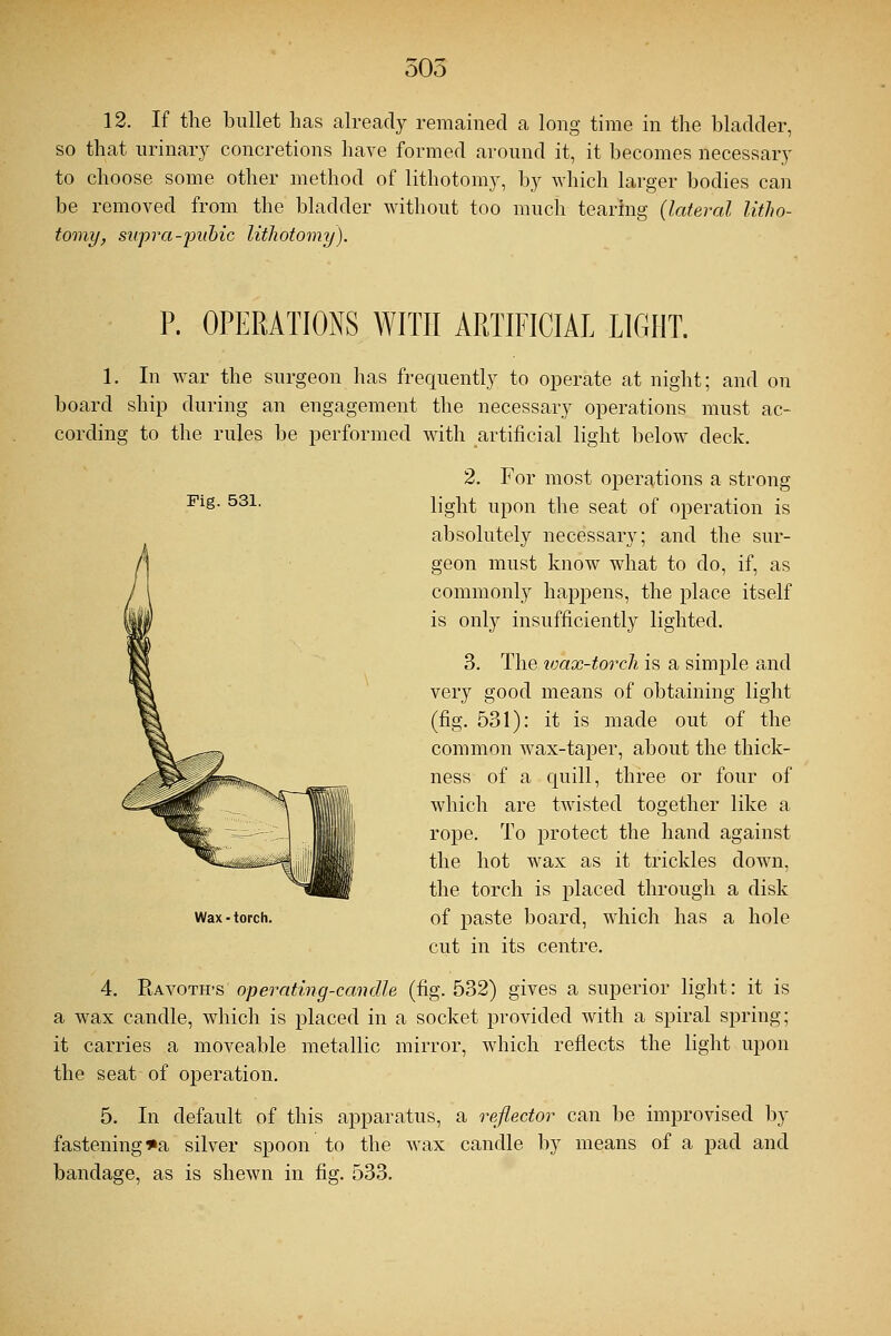 12. If the bullet has already remained a long time in the bladder, so that urinary concretions have formed around it, it becomes necessary to choose some other method of lithotomy, by which larger bodies can be removed from the bladder without too much tearing (lateral litho- tomy, supra-pubic lithotomy). P. OPERATIONS WITH ARTIFICIAL LIGHT. 1. In war the surgeon has frequently to operate at night; and on board ship during an engagement the necessary operations must ac- cording to the rules be performed with artificial light below deck. Fig. 531. Wax - torch. 2. For most operations a strong light upon the seat of operation is absolutely necessary; and the sur- geon must know what to do, if, as commonly happens, the place itself is only insufficiently lighted. 3. The wax-torch is a simple and very good means of obtaining light (fig. 531): it is made out of the common wax-taper, about the thick- ness of a quill, three or four of which are twisted together like a rope. To protect the hand against the hot wax as it trickles down, the torch is placed through a disk of paste board, which has a hole cut in its centre. 4. Ravoth-s operating-candle (fig. 532) gives a superior light: it is a wax candle, which is placed in a socket provided with a spiral spring; it carries a moveable metallic mirror, which reflects the light upon the seat of operation. 5. In default of this apparatus, a reflector can be improvised by fastening *a silver spoon to the wax candle by means of a pad and bandage, as is shewn in fig. 533.