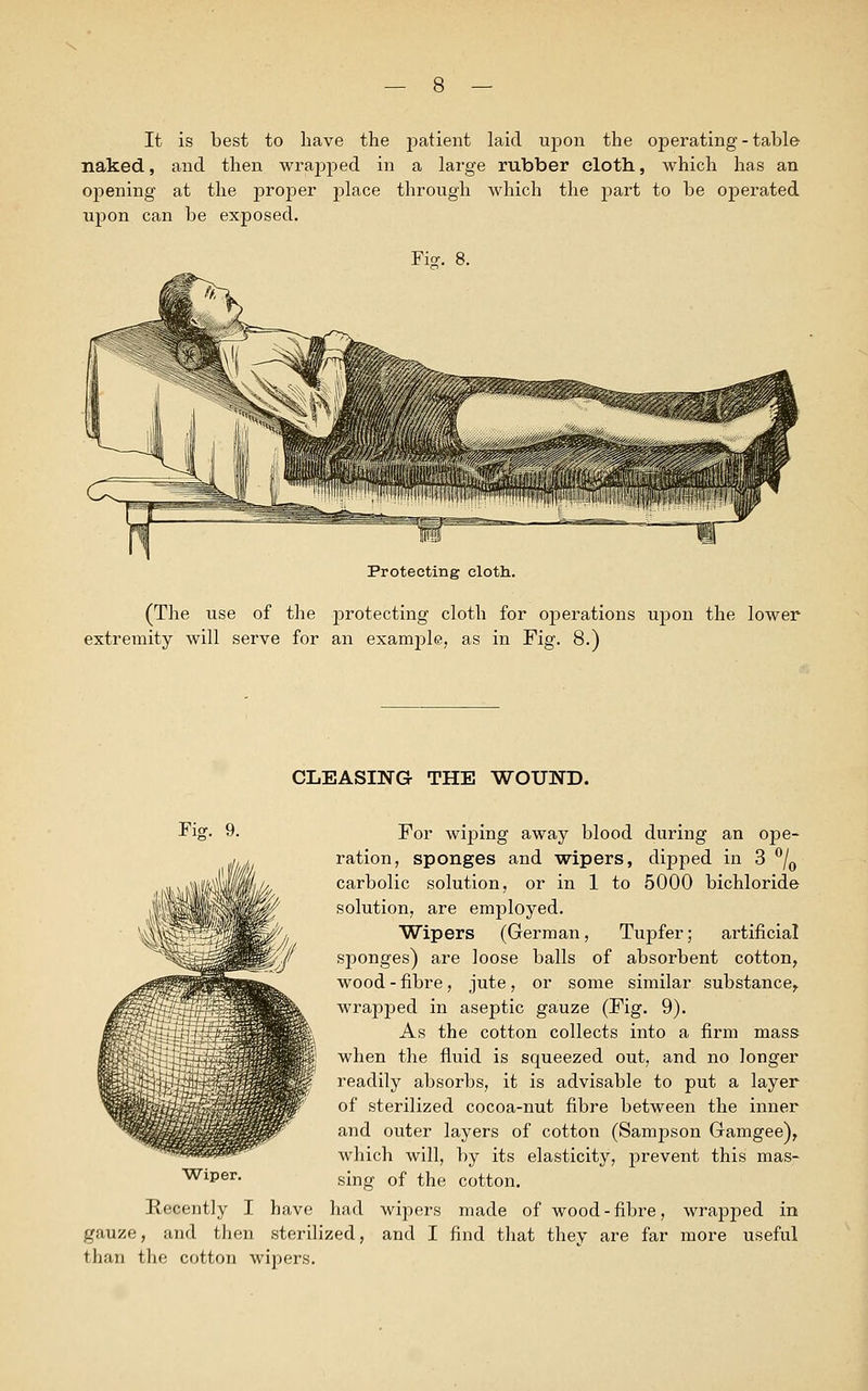 It is best to have the patient laid upon the operating - table- naked, and then wrapped in a large rubber cloth, which has an opening at the proper place through which the part to be operated upon can be exposed. Fi<r. 8. Protecting cloth. (The use of the protecting cloth for operations upon the lower extremity will serve for an example, as in Fig. 8.) CLEASING THE WOUND. Fig. 9. For wiping away blood during an ope- ration, sponges and wipers, dipped in 3 °/0 carbolic solution, or in 1 to 5000 bichloride solution, are employed. Wipers (German, Tupfer; artificial sponges) are loose balls of absorbent cotton, wood - fibre, jute, or some similar substance, wrapped in aseptic gauze (Fig. 9). As the cotton collects into a firm mass when the fluid is squeezed out, and no longer readily absorbs, it is advisable to put a layer of sterilized cocoa-nut fibre between the inner and outer layers of cotton (Sampson Gamgee), which will, by its elasticity, prevent this mas- sing of the cotton. Recently I have had wipers made of wood-fibre, wrapped in gauze, and then sterilized, and I find that they are far more useful than the cotton wipers. Wiper.