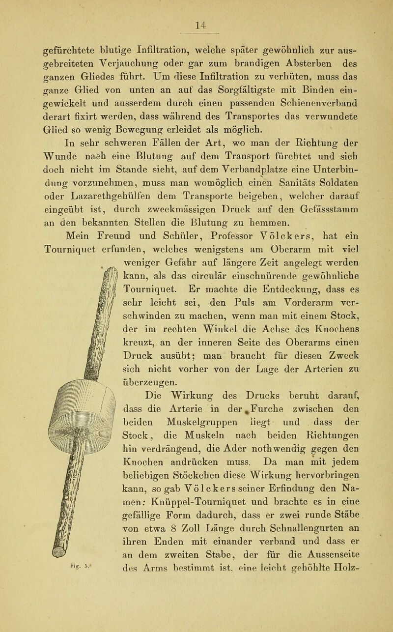 gefürchtete blutige Infiltration, welche später gewöhnlich zur aus- gebreiteten Verjauchung oder gar zum brandigen Absterben des ganzen Gliedes führt. Um diese Infiltration zu verhüten, muss das ganze Glied von unten an auf das Sorgfältigste mit Binden ein- gewickelt und ausserdem durch einen passenden Schienenverband derart fixirt werden, dass während des Transportes das verwundete Glied so wenig Bewegung erleidet als möglich. In sehr schweren Fällen der Art, wo man der Richtung der Wunde naeh eine Blutung auf dem Transport fürchtet und sich doch nicht im Stande sieht, auf dem Verbandplatze eine Unterbin- dung vorzunehmen, muss man womöglich einen Sanitäts Soldaten oder Lazarethgehülfen dem Transporte beigeben, welcher darauf eingeübt ist, durch zweckmässigen Druck auf den Gefässstamm an den bekannten Stellen die Blutung zu hemmen. Mein Freund und Schüler, Professor Völckers, hat ein Tourniquet erfunden, welches wenigstens am Oberarm mit viel weniger Gefahr auf längere Zeit angelegt werden kann, als das circulär einschnürende gewöhnliche yf Tourniquet. Er machte die Entdeckung, dass es $ sehr leicht sei, den Puls am Vorderarm ver- * schwinden zu machen, wenn man mit einem Stock, der im rechten Winkel die Achse des Knochens kreuzt, an der inneren Seite des Oberarms einen Druck ausübt; man braucht für diesen Zweck sich nicht vorher von der Lage der Arterien zu überzeugen. \ Die Wirkung des Drucks beruht darauf, V dass die Arterie in der,Furche zwischen den beiden Muskelgruppen liegt und dass der I Stock, die Muskeln nach beiden Richtungen hin verdrängend, die Ader nothwendig gegen den Knochen andrücken muss. Da man mit jedem beliebigen Stöckchen diese Wirkung hervorbringen kann, so gab Völckers seiner Erfindung den Na- men: Knüppel-Tourniquet und brachte es in eine gefällige Form dadurch, dass er zwei runde Stäbe von etwa 8 Zoll Länge durch Schnallengurten an ihren Enden mit einander verband und dass er an dem zweiten Stabe, der für die Aussenseite des Arms bestimmt ist, eine leicht gehöhlte Holz-