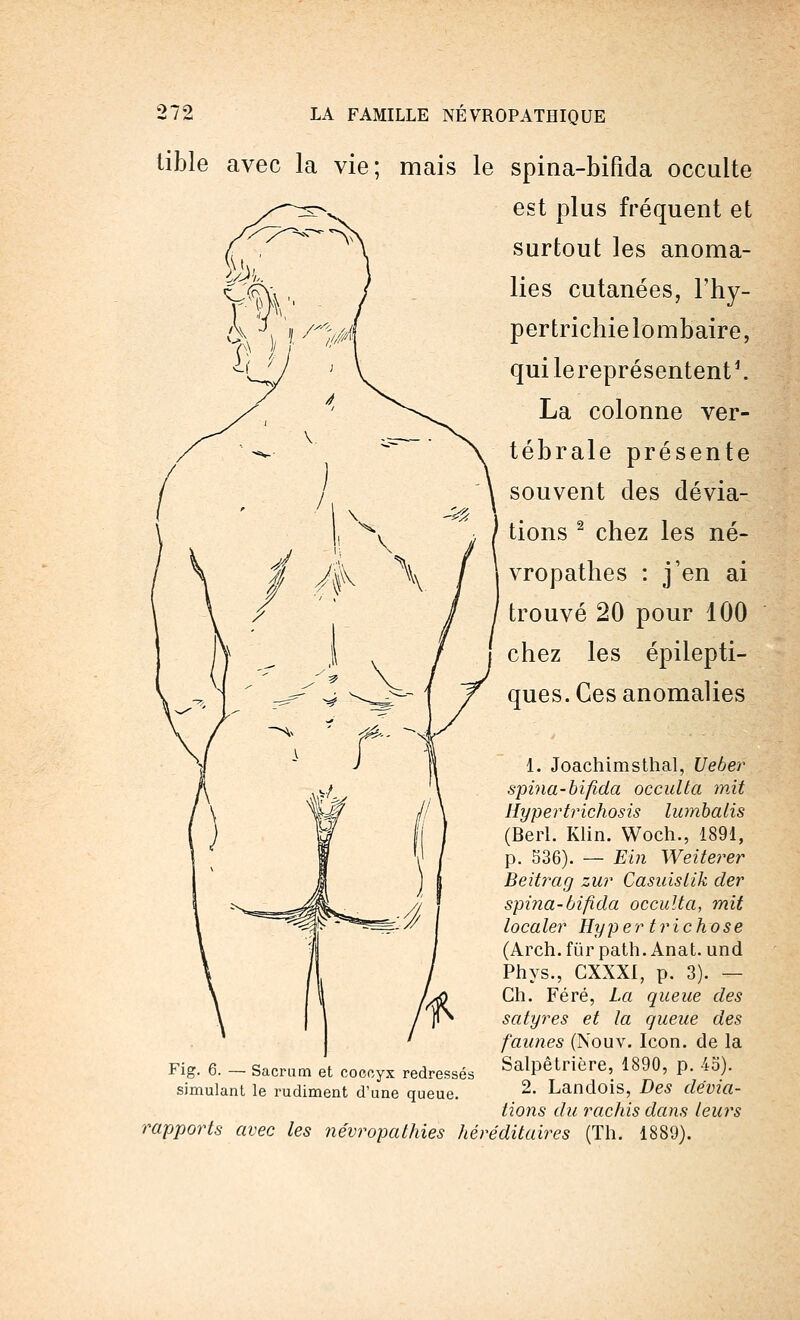 tible avec la vie; mais le spina-bifida occulte est plus fréquent et surtout les anoma- lies cutanées, Thy- pertrichie lombaire, qui lereprésentent1. La colonne ver- tébrale présente souvent des dévia- tions 2 chez les né- vropathes : j'en ai trouvé 20 pour 100 chez les épilepti- ques. Ces anomalies 1. Joachimsthal, Ueber spina-bifida occulta mit Hypertrichosis lumbalis (Beii. Klin. Woch., 1891, p. 536). — Ein Weiterer Beitrag zur Casuistik der spina-bifida occulta, mit localer Hyper trichose (Arch. fur path. Anat. und Phys., CXXX1, p. 3). — Ch. Féré, La queue des satyres et la queue des faunes (Nouv. Icon. de la Fig. 6. - Sacrum et coccyx redressés Salpêtrière, 1890, p. 45). simulant le rudiment d'une queue. 2- Landois, Des dévia- tions du rachis dans leurs rapports avec les névropathies héréditaires (Th. 1889).
