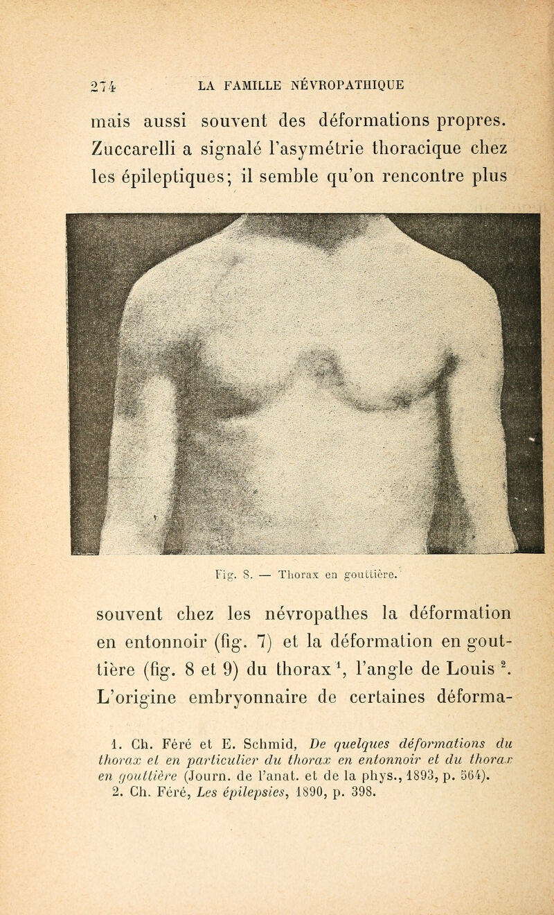 mais aussi souvent des déformations propres. Zuccarelli a signalé l'asymétrie thoracique chez les épileptiques; il semble qu'on rencontre plus Fig. S. — Thorax en gouttière. souvent chez les névropathes la déformation en entonnoir (fig. 7) et la déformation en gout- tière (fig. 8 et 9) du thoraxi, l'angle de Louis 2. L'origine embryonnaire de certaines déforma- 1. Ch. Féré et E. Schmid, De quelques déformations du thorax et en particulier du thorax en entonnoir et du thorax, en gouttière (Journ. de l'anat. et de la phys., 1893, p. 564). 2. Ch. Féré, Les épilepsies, 1890, p. 398.