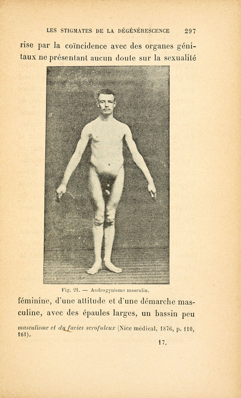 rise par la coïncidence avec des organes géni- taux ne présentant aucun doute sur la sexualité F- ■'A Fig. 21. — Androgynisme masculin. féminine, d'une attitude et d'une démarche mas- culine, avec des épaules larges, un bassin peu masculisme et chifacies scrofuleux (Nice médical, 1876, p. 110 161). 17.