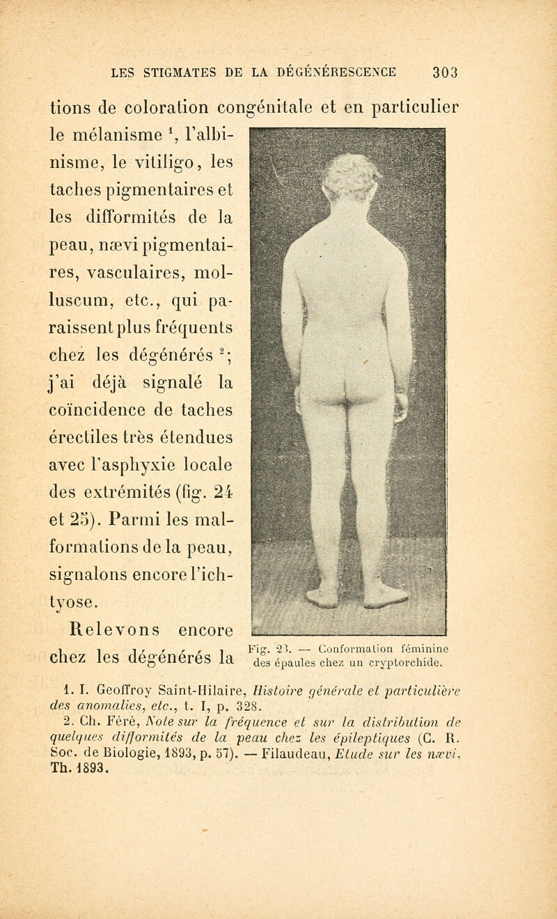 BÊMM m '■. tions de coloration congénitale et en particulier le mélanisme *, l'albi- nisme, le vitiligo, les taches pigmentaires et les difformités de la peau, nsevi pigmentai- res, vasculaires, mol- luscum, etc., qui pa- raissent plus fréquents chez les dégénérés 2; j'ai déjà signalé la coïncidence de taches érectiles très étendues avec l'asphyxie locale des extrémités (fig. 24 et 25). Parmi les mal- formations de la peau, signalons encore l'ich- tvose. Relevons encore chez les dégénérés la Fig. 2:5. — Conformation féminine des épaules chez un cryptorchide. 1. I. Geoffroy Saint-Hilaire, Histoire générale et particulière des anomalies, etc., t. I, p. 328. 2. Ch. Féré, Note sur la fréquence et sur la distribution de quelques difformités de la peau chez les épileptiques (C. R. Soc. de Biologie, 1893, p. 57). — Filaudeau, Etude sur les nœvi, Th. 1893.