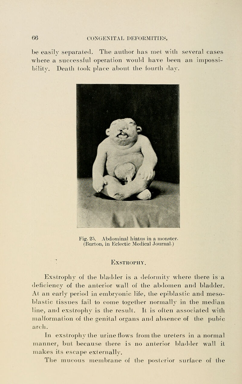 be easily separated. The author has met with several cases where a successful operation would have been an impossi- bility. Death took place about the fourth day. Fig. 2o. Abdominal hiatus in a monster. (Burton, in Eclectic Medical Journal.) Exstrophy. Exstrophy of the bladder is a deformity where there is a deficiency of the anterior wall of the abdomen and bladder. At an early jjeriod in embryonic life, the epiblastic and nieso- Ijlastic tissues fail to coine together normally in the median line, and exstrophy is the result. It is often associated with malformation of tlie genital organs and absence of the pubic arch. In exstrophy the urine flows from the ureters in a normal manner, but because there is no anterior bladder wall it makes its escape externallv. The mucous membrane of the posterior surface of the