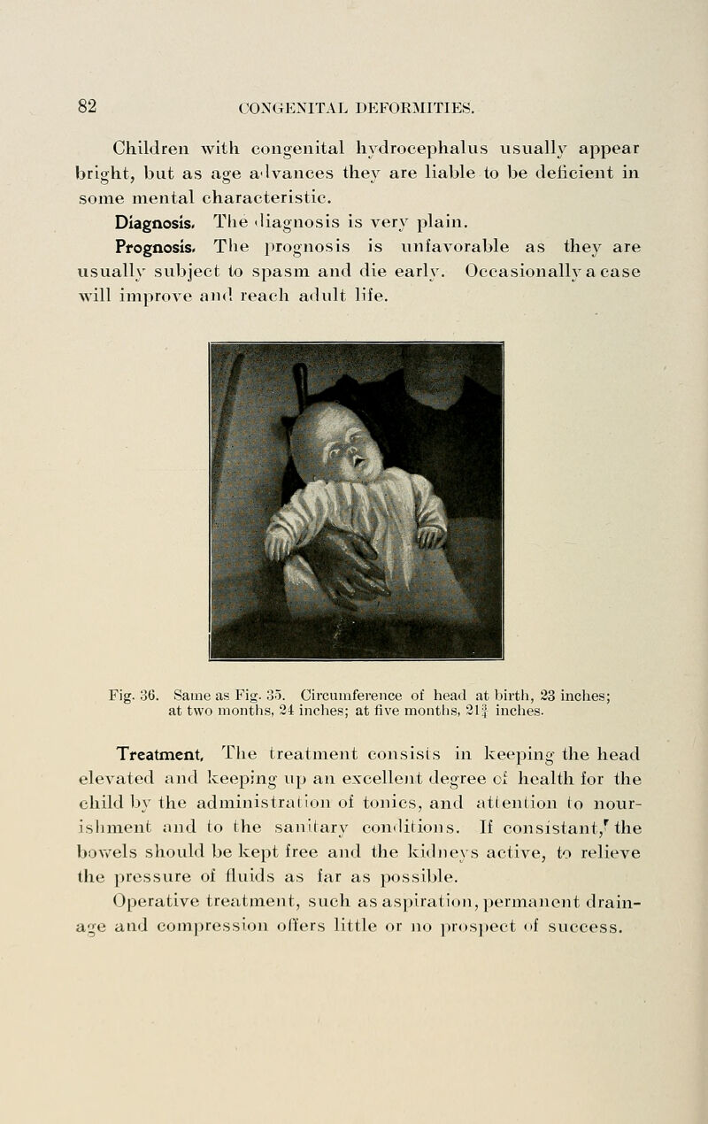 Children with congenital hydrocephalus usually appear briofht, but as age advances thev are liable to be delicient in some mental characteristic. Diagnosis. Tiie <liagnosis is very plain. Prognosis. The prognosis is unfavorable as they are usually subject to spasm and die early. Occasionally a case will improve and reach adult life. Fig. 36. Same as Fig. 35. Circumference of head at birth, 23 inclies; at two months, 24 inches; at five months, 2I4- inches. Treatment, The treatment consists in keeping the head elevated and keeping up an excellent degree of health for the child by the administration of tonics, and atlention (o nour- isliment and to the sanitar}^ couilitioiis. If consistant/the bovv^els should be kept free and the kidneys active, to relieve the pressure of fluids as far as possible. Operative treatment, such as aspiration, permanent drain- age and compression offers little or no prospect of success.