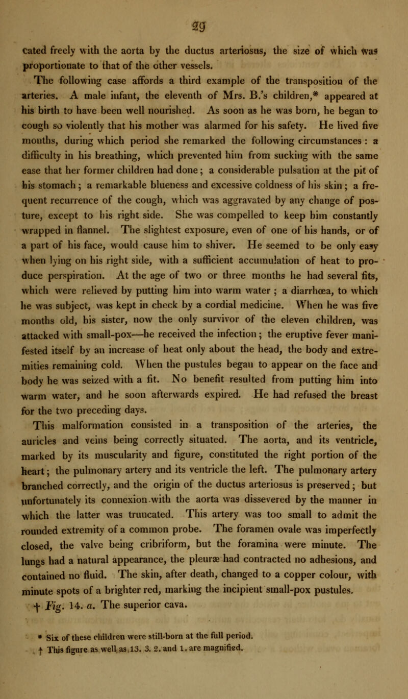 cated freely with the aorta by the ductus arteriosus, the size of which Was proportionate to that of the other vessels. The following case affords a third example of the transposition of the arteries. A male infant, the eleventh of Mrs. B.'s children,* appeared at his birth to have been well nourished. As soon as he was born, he began to cough so violently that his mother was alarmed for his safety. He lived five months, during which period she remarked the following circumstances : a difficulty in his breathing, which prevented hiin from sucking with the same ease that her former children had done; a considerable pulsation at the pit of his stomach ; a remarkable blueness and excessive coldness of his skin ; a fre- quent recurrence of the cough, which was aggravated by any change of pos- ture, except to his right side. She was compelled to keep him constantly wrapped in flannel. The slightest exposure, even of one of his hands, or of a part of his face, would cause him to shiver. He seemed to be only easy when lying on his right side, with a sufficient accumulation of heat to pro- duce perspiration. At the age of two or three months he had several fits, which were relieved by putting him into warm water ; a diarrhoea, to which he was subject, was kept in chnck by a cordial medicine. When he was five months old, his sister, now the only survivor of the eleven children, was attacked with small-pox—he received the infection; the eruptive fever mani- fested itself by an increase of heat only about the head, the body and extre- mities remaining cold. When the pustules began to appear on the face and body he was seized with a fit. No benefit resulted from putting him into warm water, and he soon afterwards expired. He had refused the breast for the two preceding days. This malformation consisted in a transposition of the arteries, the auricles and veins being correctly situated. The aorta, and its ventricle, marked by its muscularity and figure, constituted the right portion of the heart; the pulmonary artery and its ventricle the left. The pulmonary artery branched correctly, and the origin of the ductus arteriosus is preserved; but unfortunately its connexion with the aorta was dissevered by the manner in which the latter was truncated. This artery was too small to admit the rounded extremity of a common probe. The foramen ovale was imperfectly closed, the valve being cribriform, but the foramina were minute. The lungs had a natural appearance, the pleurae had contracted no adhesions, and contained no fluid. The skin, after death, changed to a copper colour, with minute spots of a brighter red, marking the incipient small-pox pustules. f Fig. 14. a. The superior cava. • Six of these children were still-bom at the full period. f This figure as well, as 13. 3. 2. and 1. are magnified.