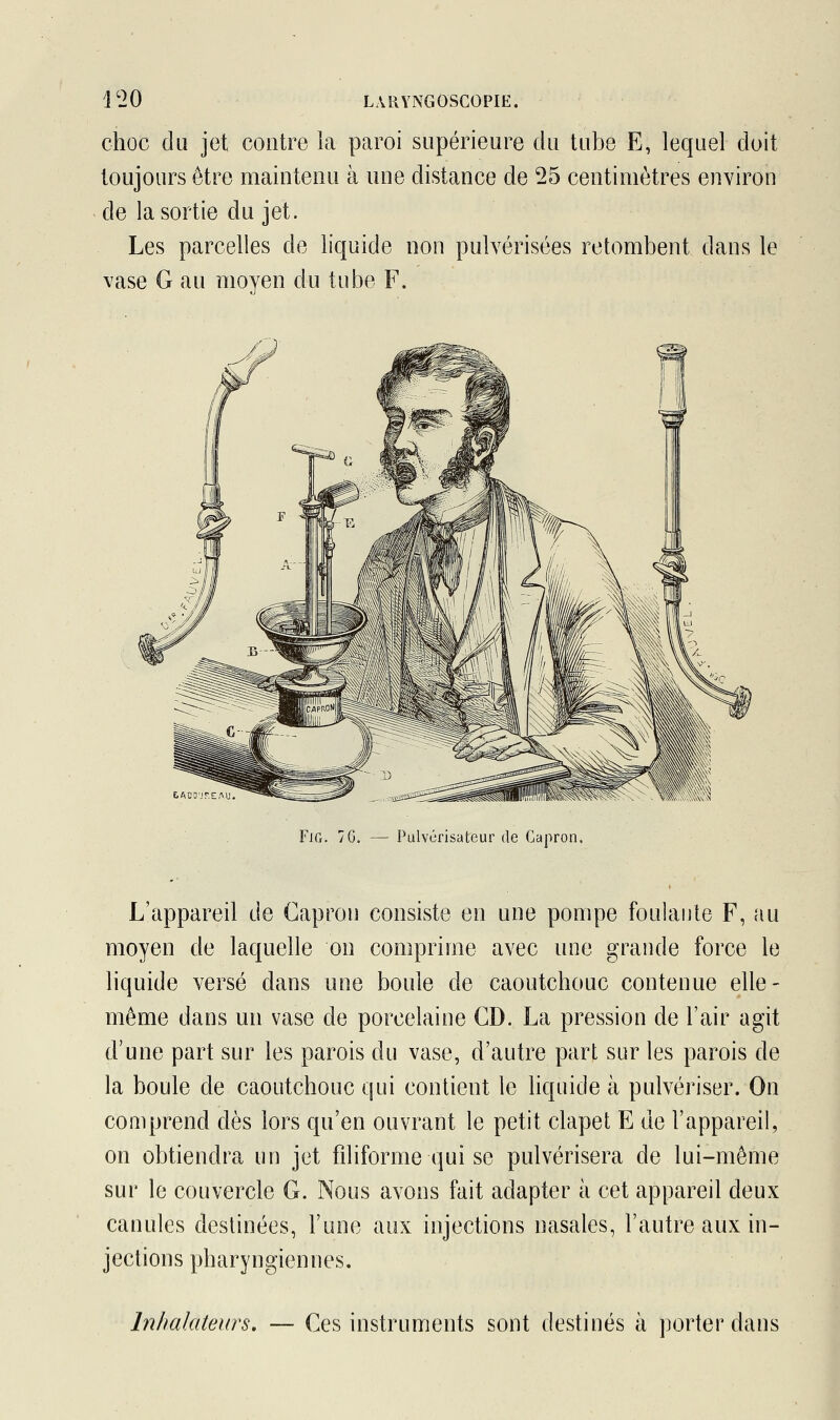 choc du jet contre la paroi supérieure du tube E, lequel doit toujours être maintenu à une distance de 25 centimètres environ de la sortie du jet. Les parcelles de liquide non pulvérisées retombent dans le vase G au moyen du tube F. FiCr. 7G. — Pulvérisateur de Capron, L'appareil de Capron consiste en une pompe foulante F, au moyen de laquelle on comprime avec une grande force le liquide versé dans une boule de caoutchouc contenue elle- même dans un vase de porcelaine CD. La pression de l'air agit d'une part sur les parois du vase, d'autre part sur les parois de la boule de caoutchouc qui contient le liquide à pulvériser. On comprend dès lors qu'en ouvrant le petit clapet E de l'appareil, on obtiendra un jet filiforme qui se pulvérisera de lui-même sur le couvercle G. Nous avons fait adapter à cet appareil deux canules destinées, l'une aux injections nasales, l'autre aux in- jections pharyngiennes. Inhalateurs. — Ces instruments sont destinés à porter dans