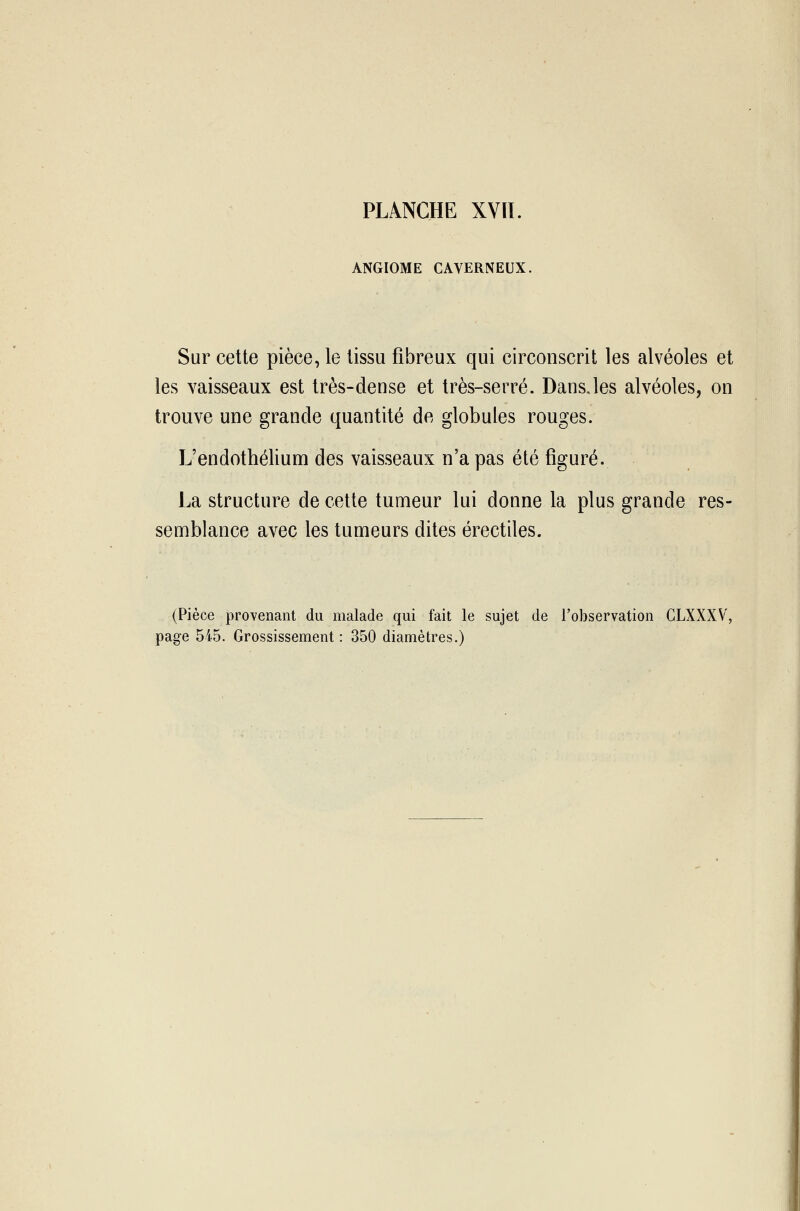 ANGIOME CAVERNEUX Sur cette pièce, le tissu fibreux qui circonscrit les alvéoles et les vaisseaux est très-dense et très-serré. Dans,les alvéoles, on trouve une grande quantité de globules rouges. L'endothélium des vaisseaux n'a pas été figuré. La structure de cette tumeur lui donne la plus grande res- semblance avec les tumeurs dites érectiles. (Pièce provenant du malade qui fait le sujet de l'observation CLXXXV,
