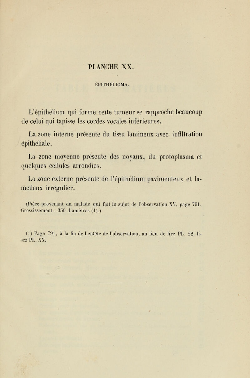 ÉPITHÉLIOMA. L'épithélium qui forme cette tumeur se rapproche beaucoup de celui qui tapisse les cordes vocales inférieures. La zone interne présente du tissu lamineux avec infiltration épithéliale. La zone moyenne présente des noyaux, du protoplasma et quelques cellules arrondies. La zone externe présente de l'épithélium pavimenteux et la- melleux irrégulier. (Pièce provenant du malade qui fait le sujet de l'observation XV, page 791. Grossissement : 350 diamètres (1).) (1) Page 791, à la fin de l'entête de l'observation, au lieu de lire PL. 22, li- sez PL. XX.